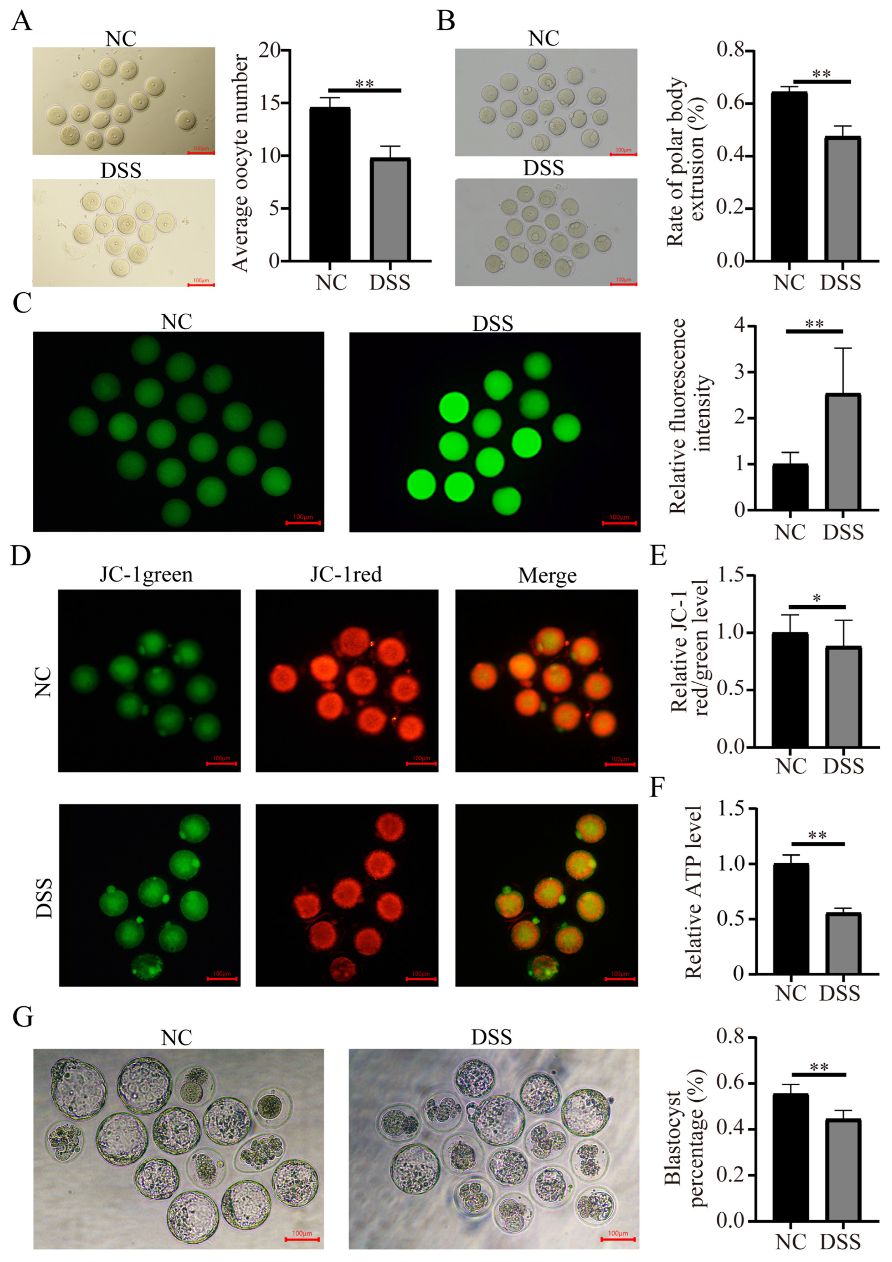 Nutrients 15 02425 g006 Nutrients 15 02425 g006