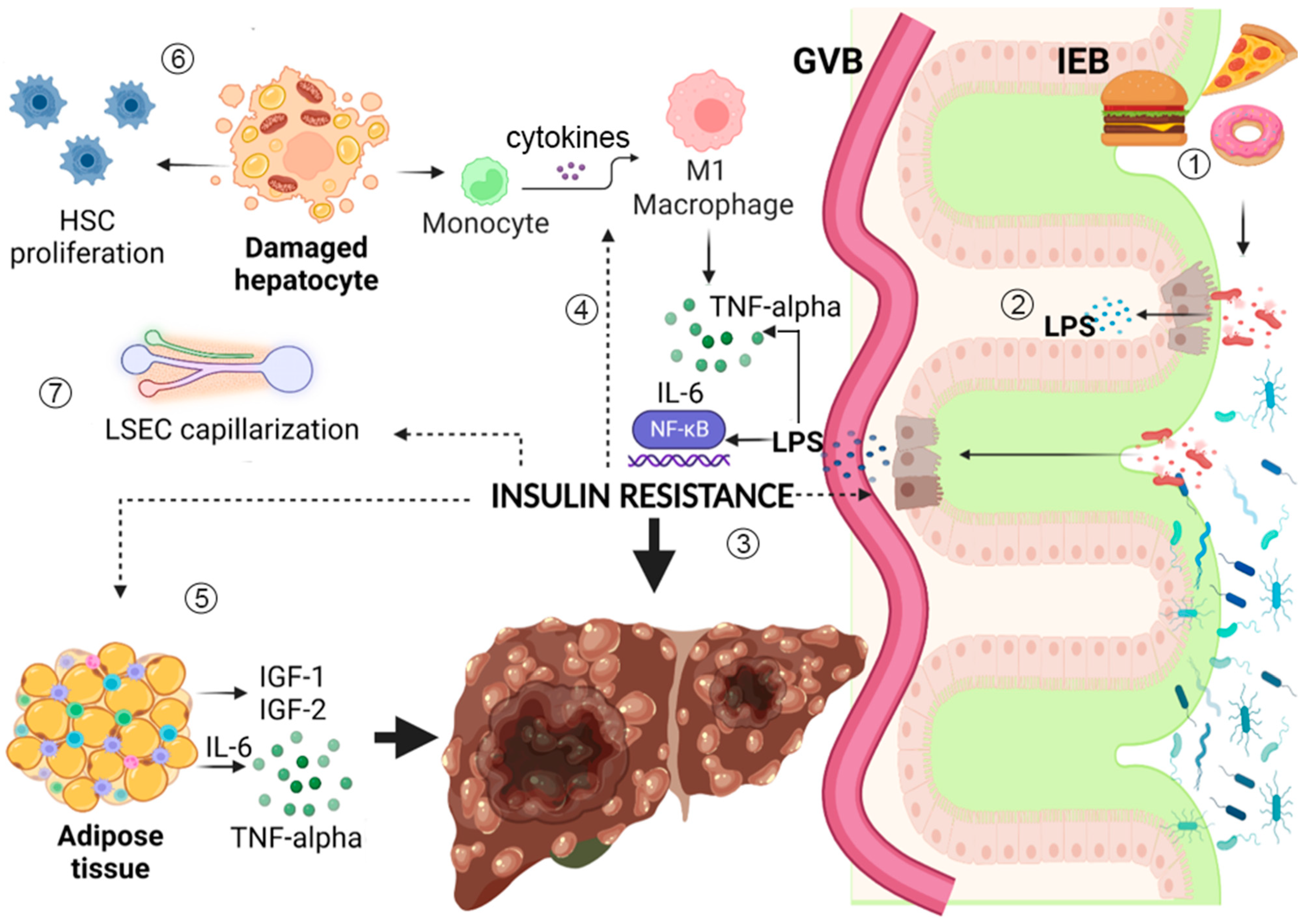 Type 20 Diabetes Mellitus and Liver Disease Across the Gut&ndash ...