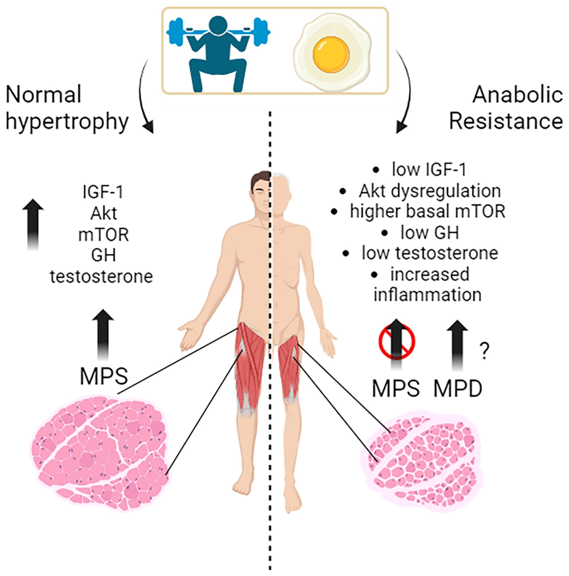 Nutrients Free Full-Text Anabolic Resistance in the Pathogenesis of Sarcopenia in the Elderly Role of Nutrition and Exercise in Young and Old People Porn Pic Hd