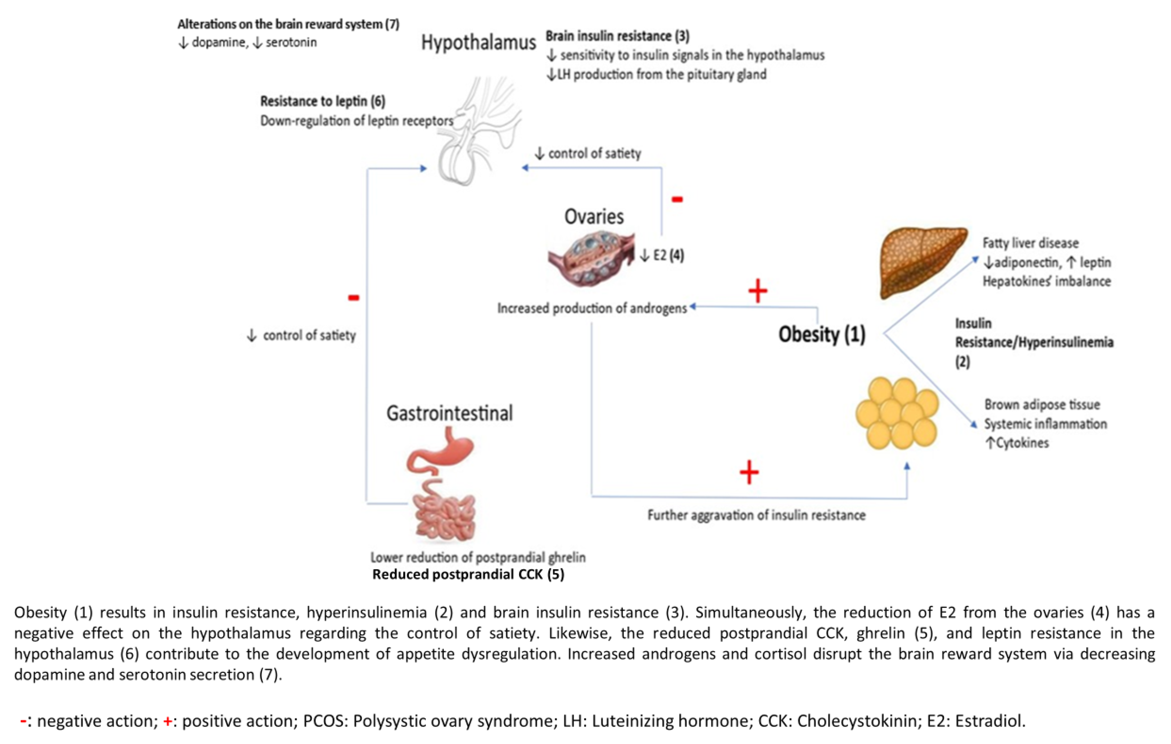 Food Cravings and Obesity in Women with Polycystic Ovary Syndrome ...