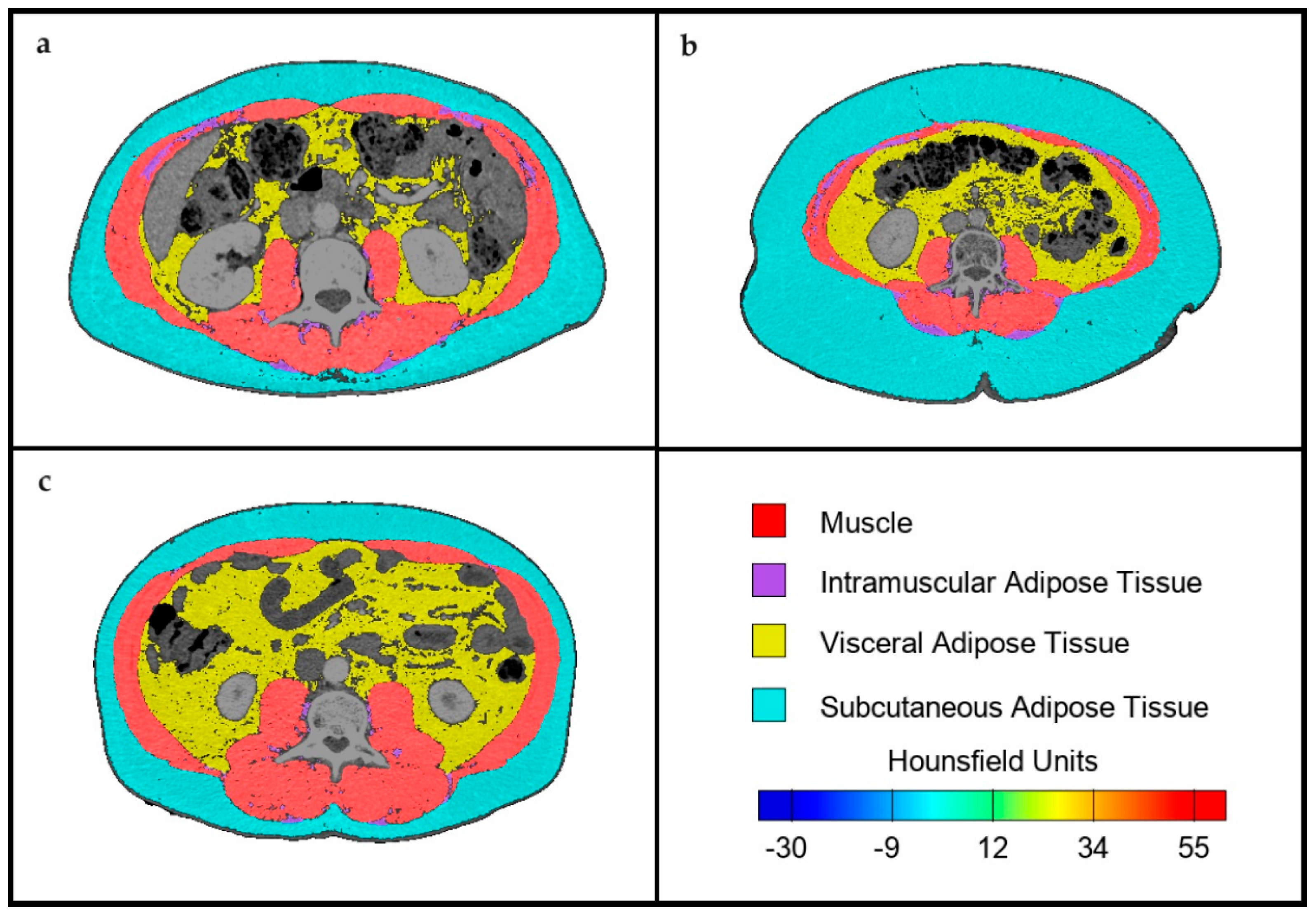 Nutrients 16 01869 g001