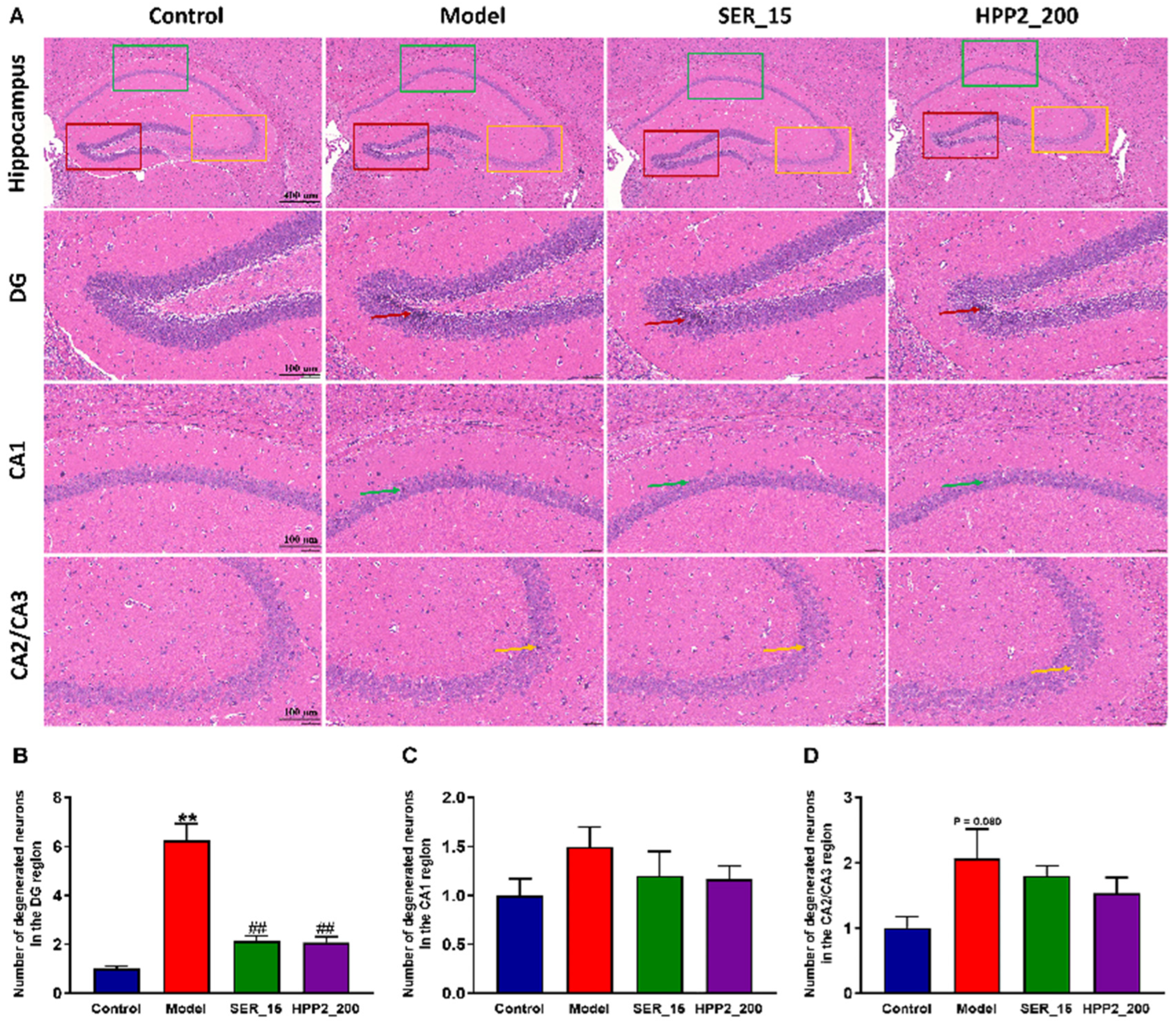 Nutrients 17 03222 g006 Nutrients 17 03222 g006