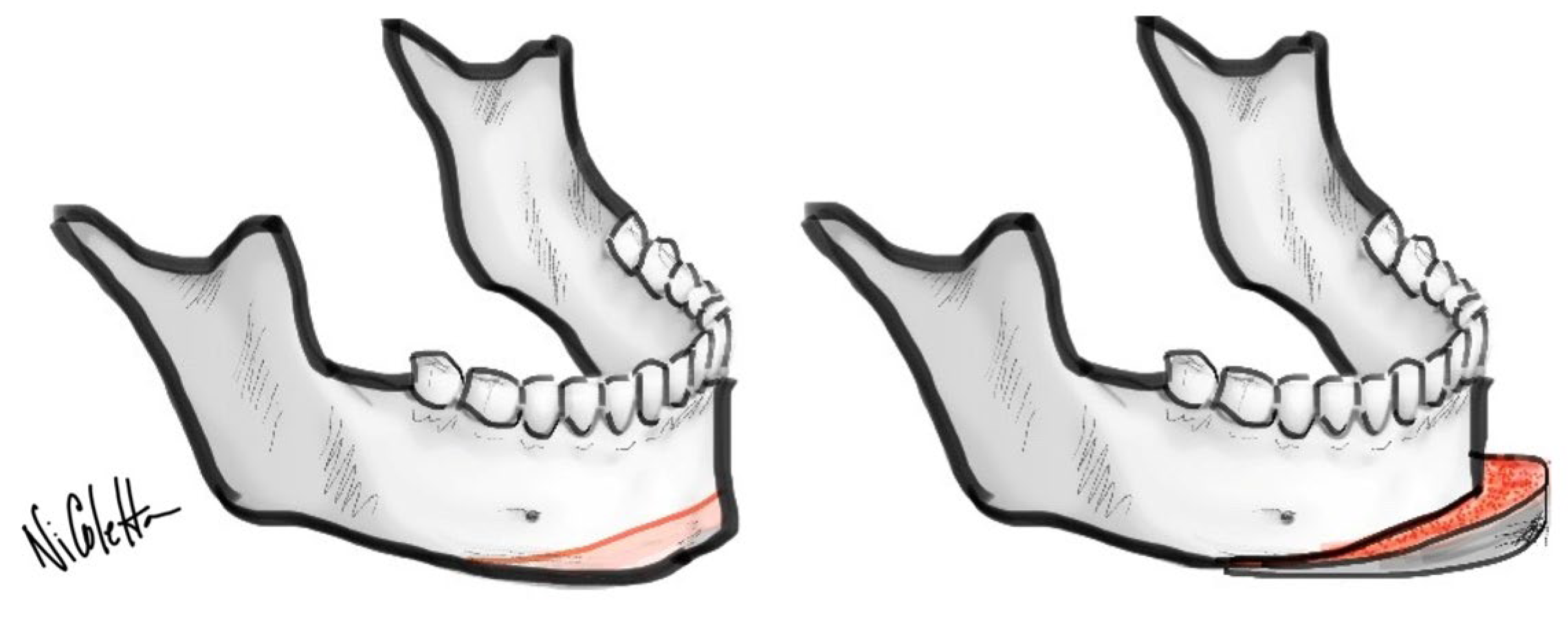 Oral 03 00009 g002 Oral 03 00009 g002