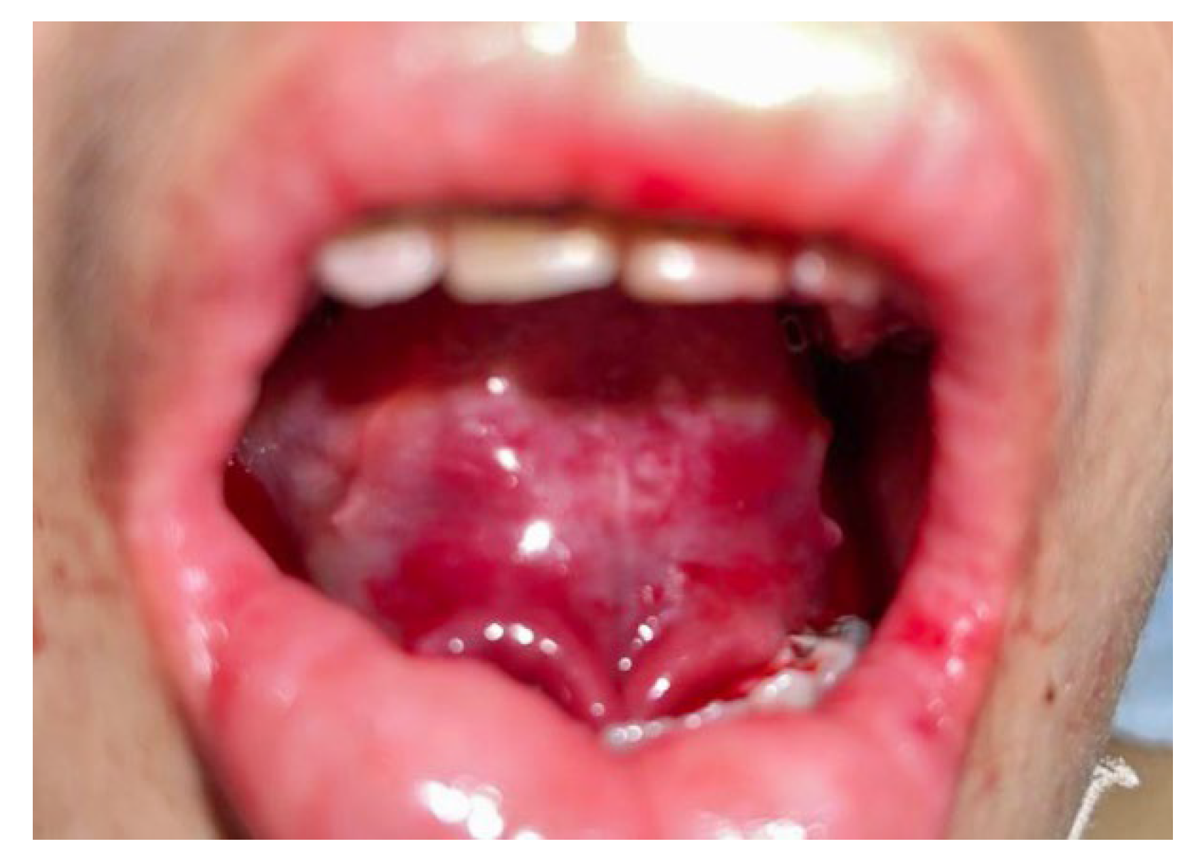 Oral 03 00009 g003 Oral 03 00009 g003