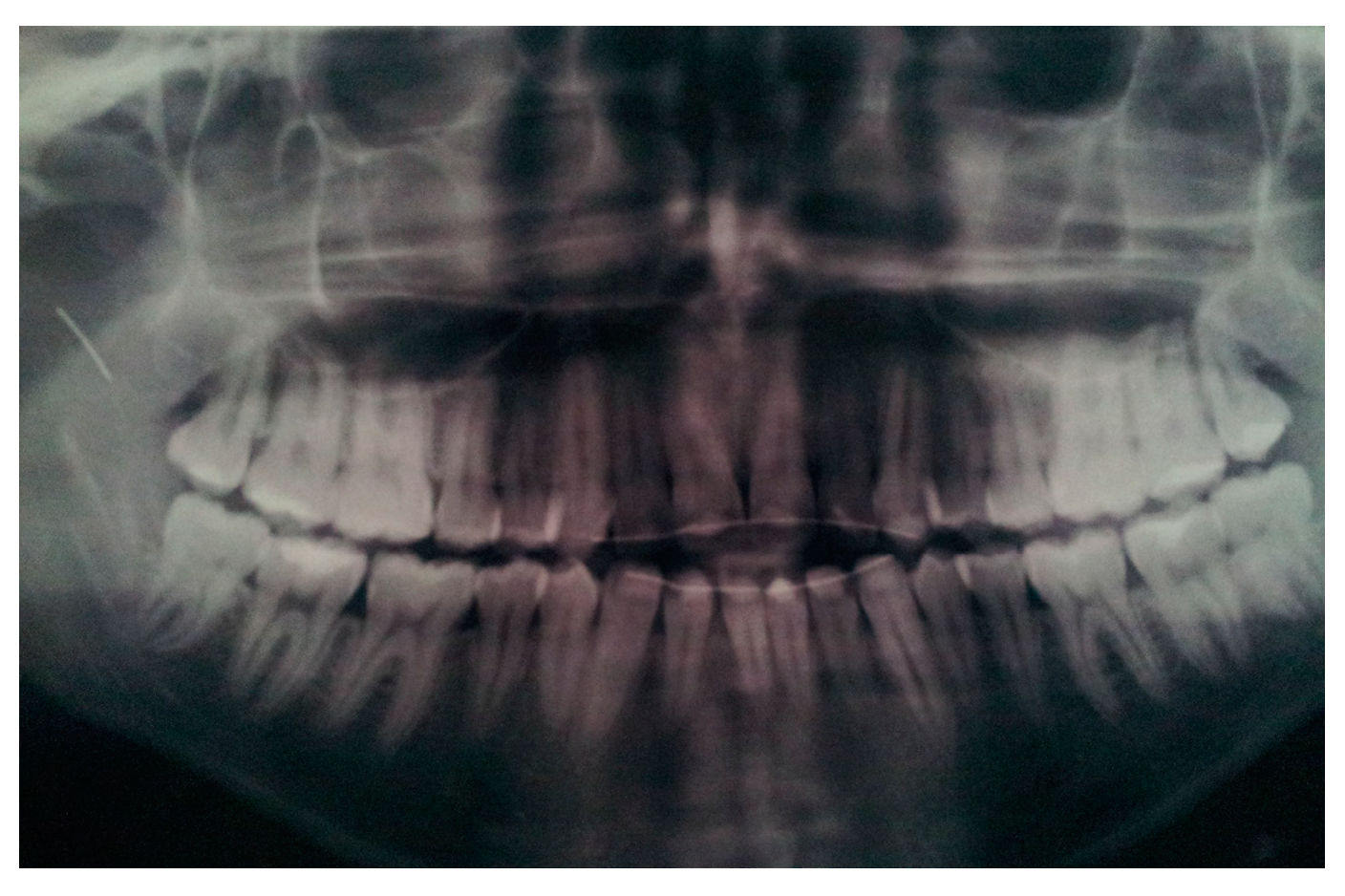 Oral 03 00013 g003 Oral 03 00013 g003