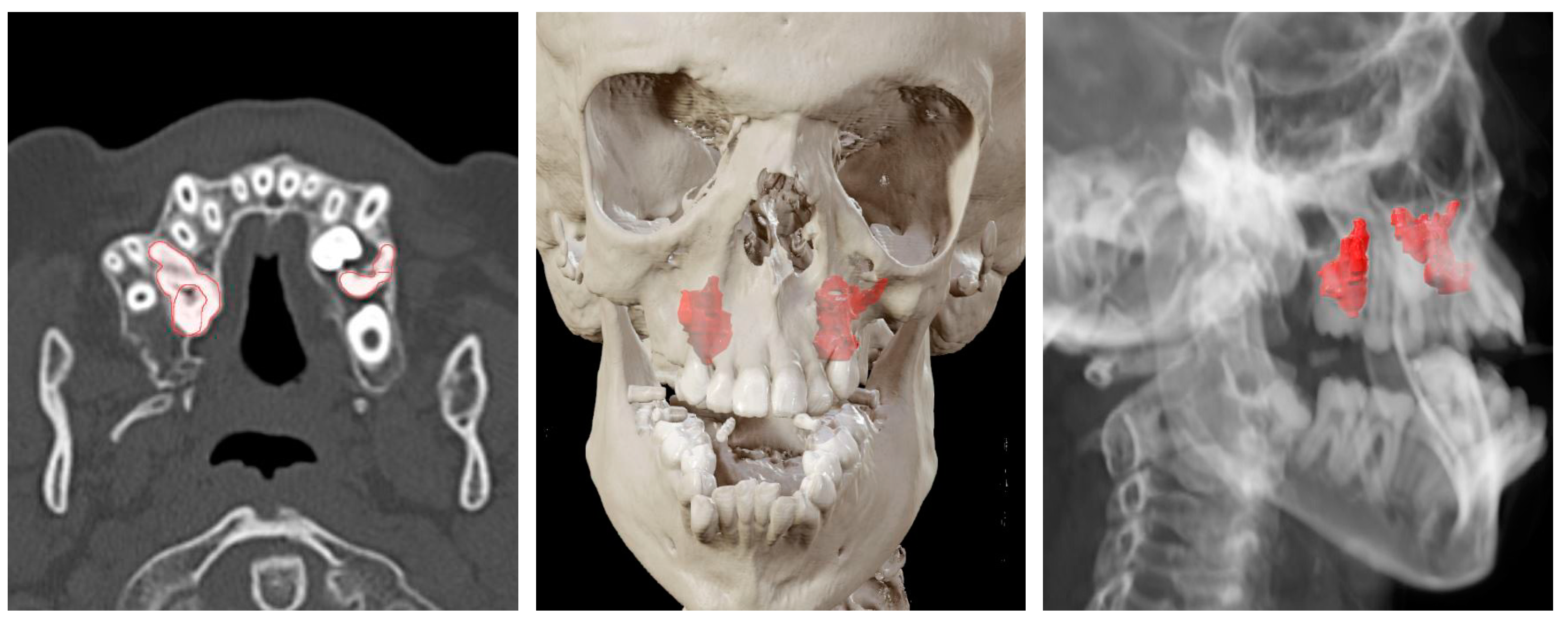 Oral 03 00013 g006 Oral 03 00013 g006