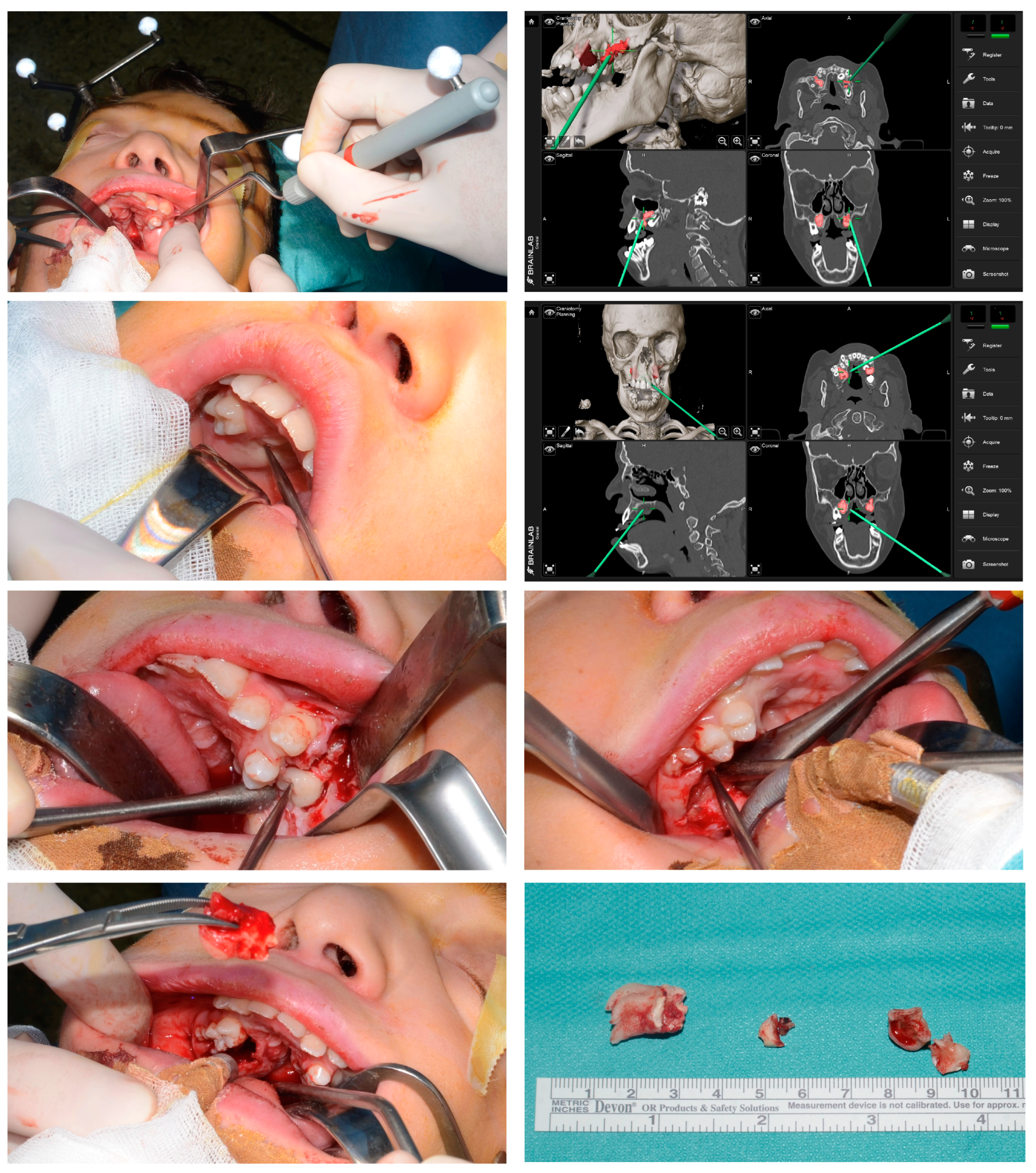 Oral 03 00013 g007 Oral 03 00013 g007