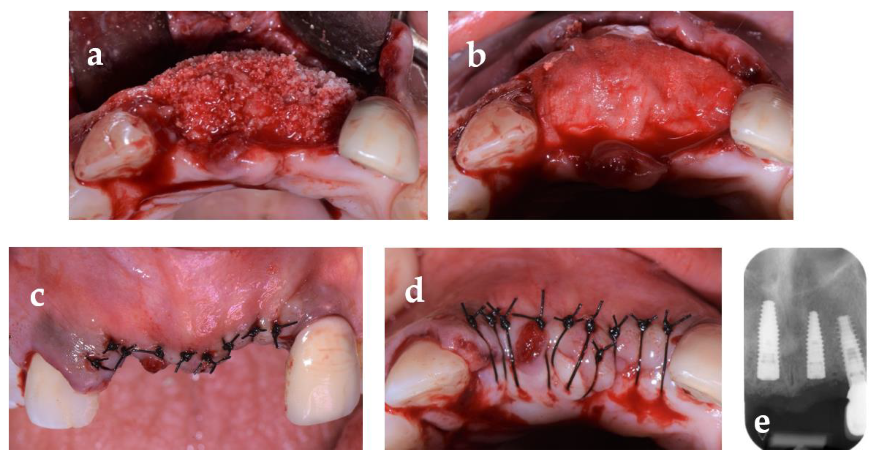 Oral 04 00021 g005