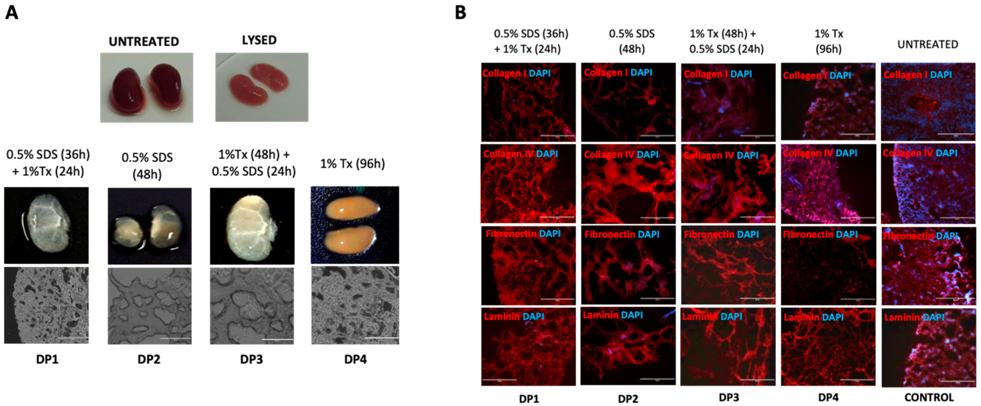 Organoids Free Full Text Decellularization of Mouse Kidneys to