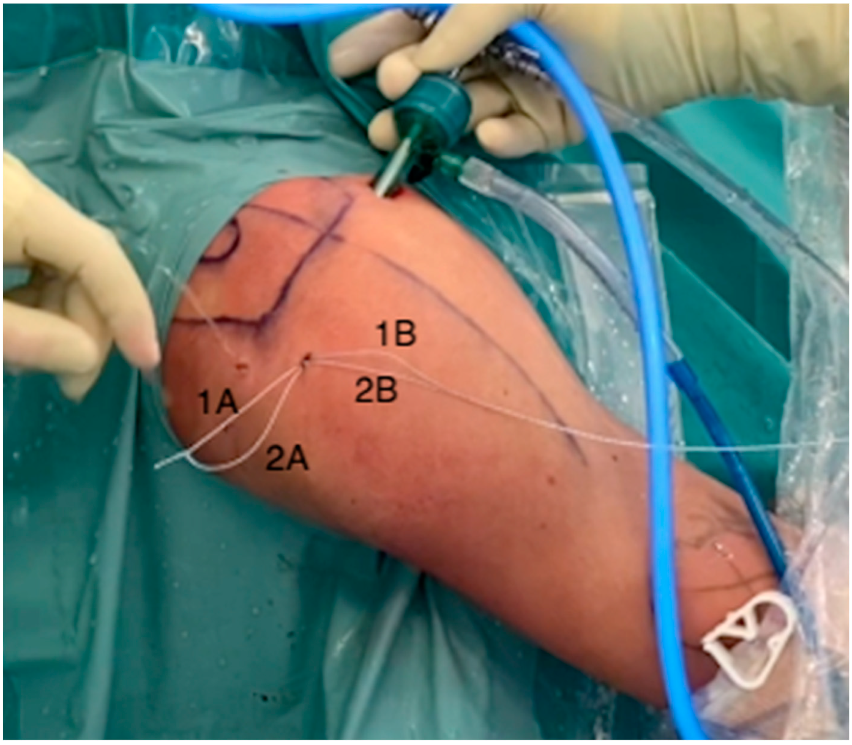 Osteology 02 00018 g003 Osteology 02 00018 g003