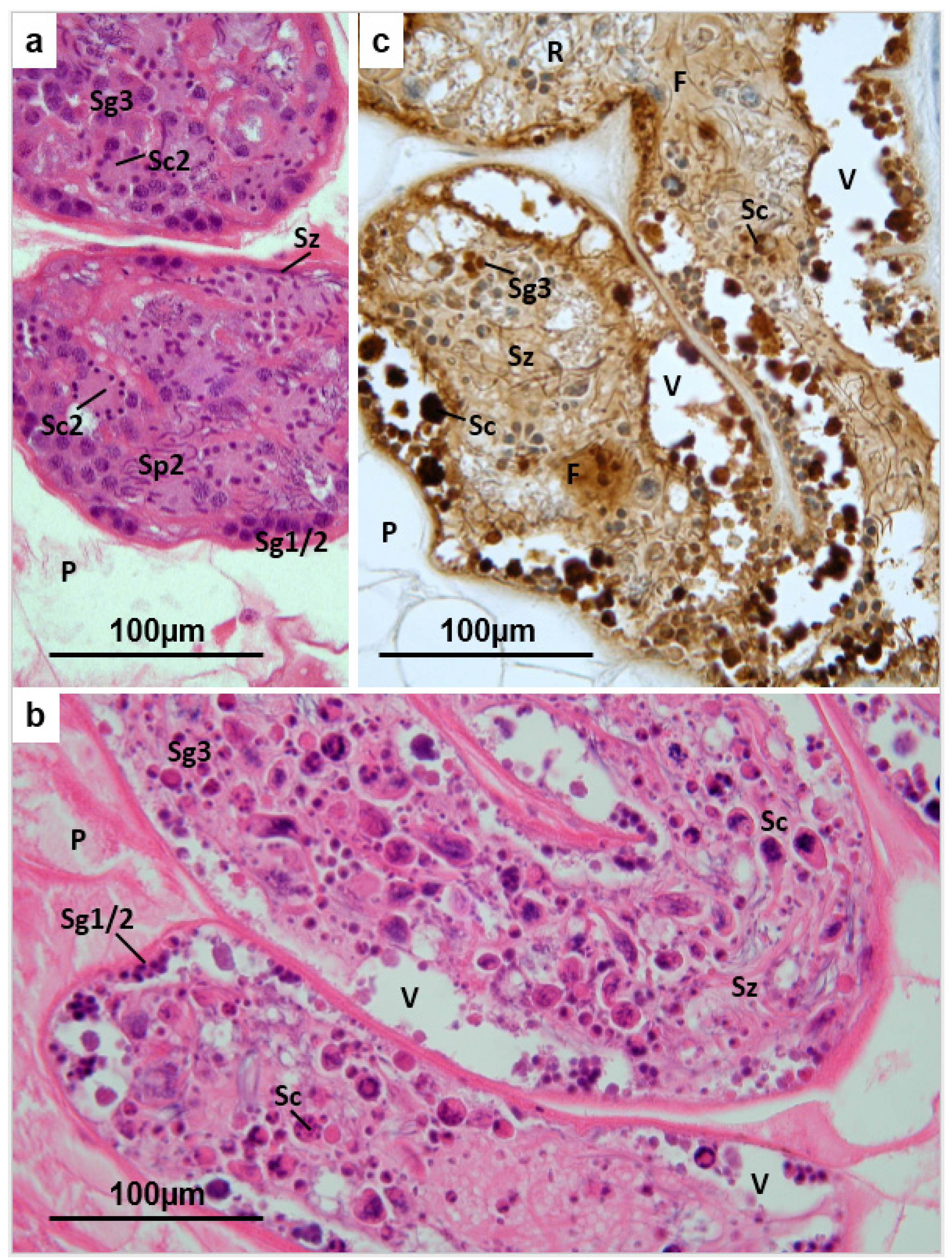 fasciola hepatica slide