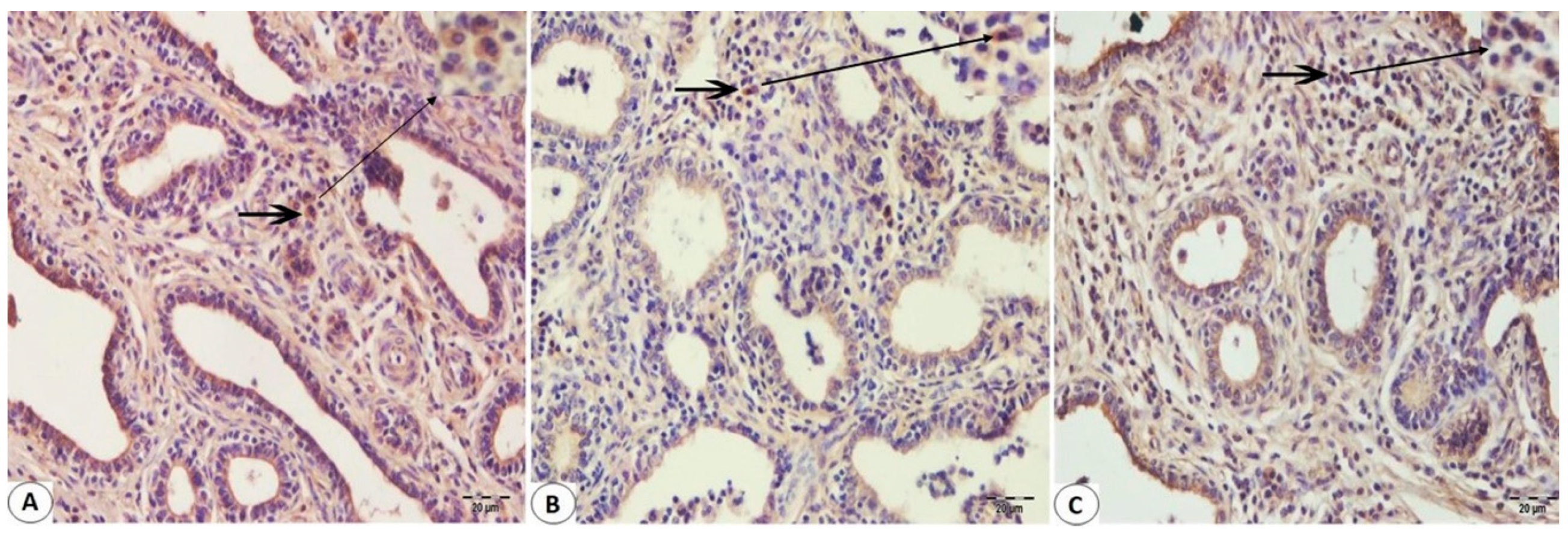 parainfluenza type 3