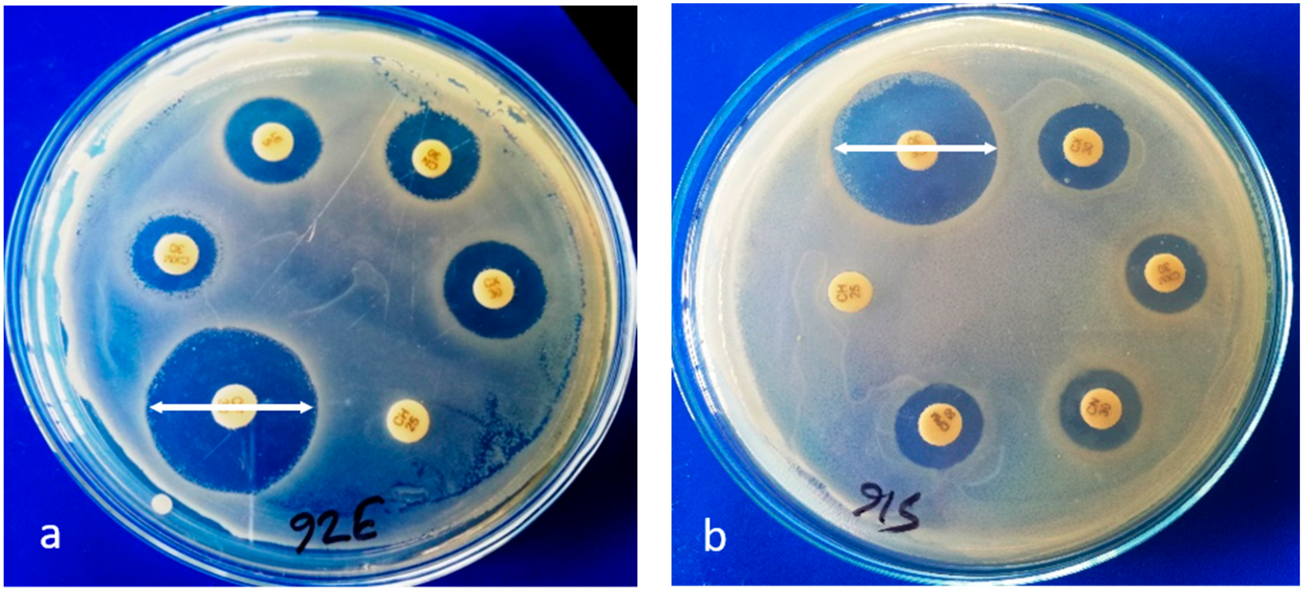 Pathogens | Free Full-Text | Antimicrobial Resistance Pattern of  Escherichia coli Isolated from Frozen Chicken Meat in Bangladesh | HTML