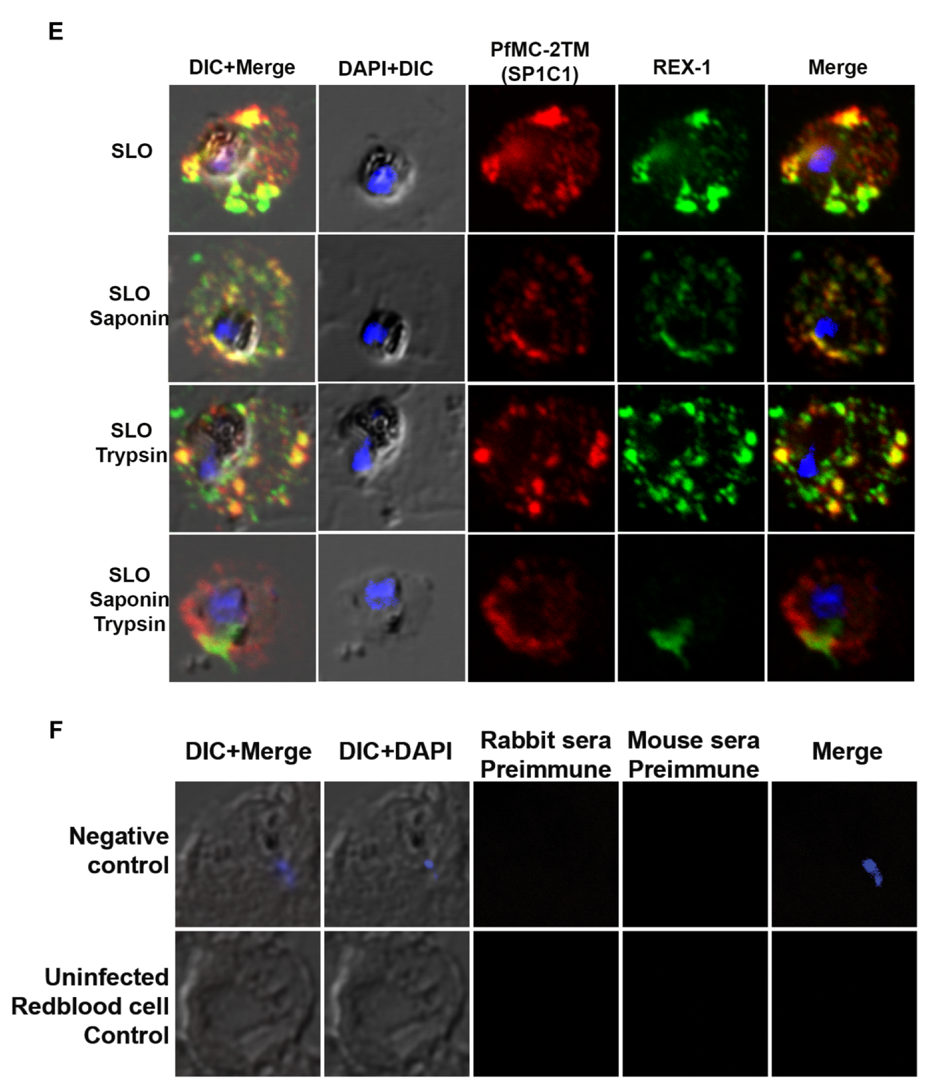 Pathogens 10 00431 g007c Pathogens 10 00431 g007c