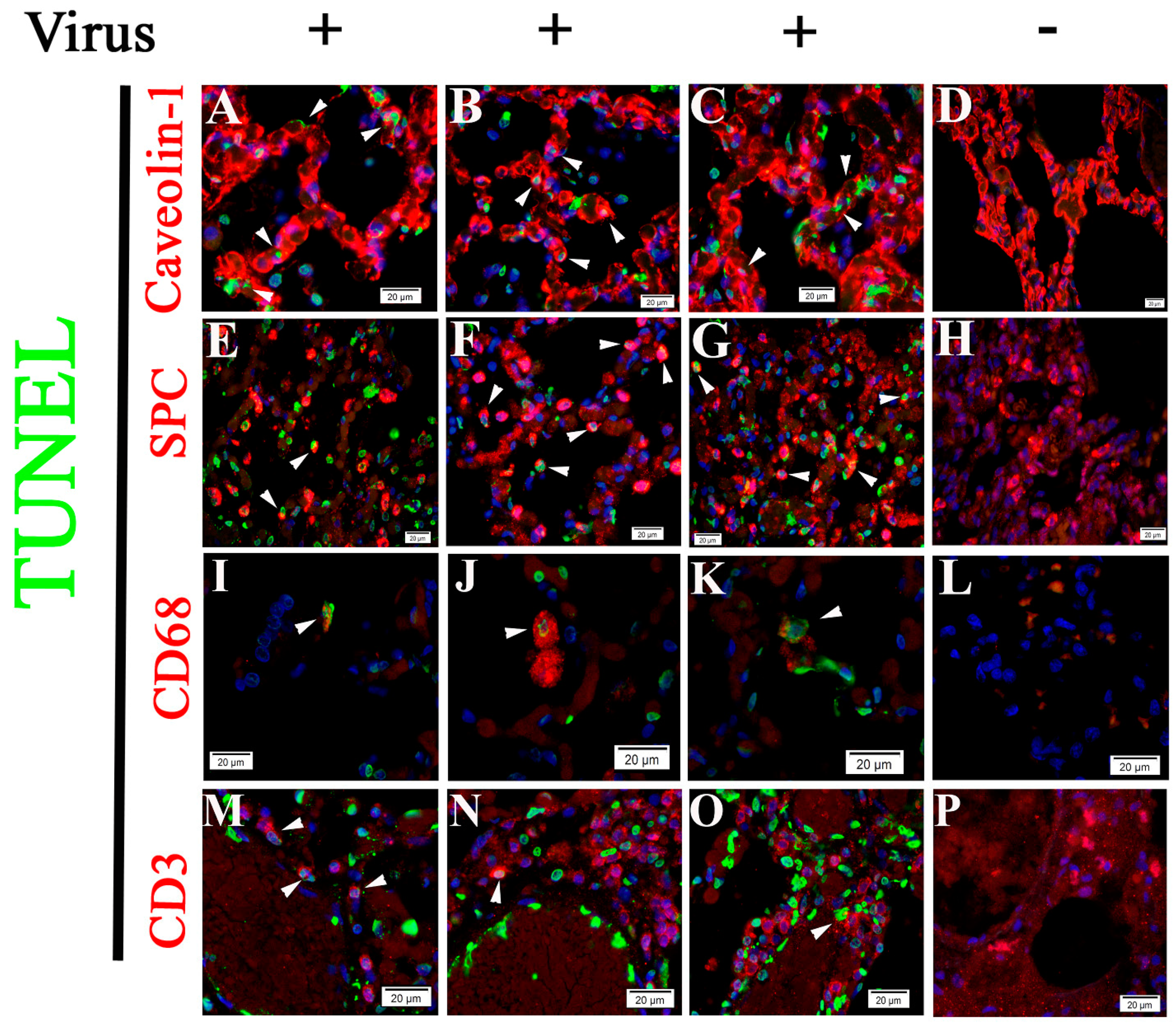 Pathogens Free Full Text Cell Type Apoptosis In Lung During Sars Cov 2 Infection Html