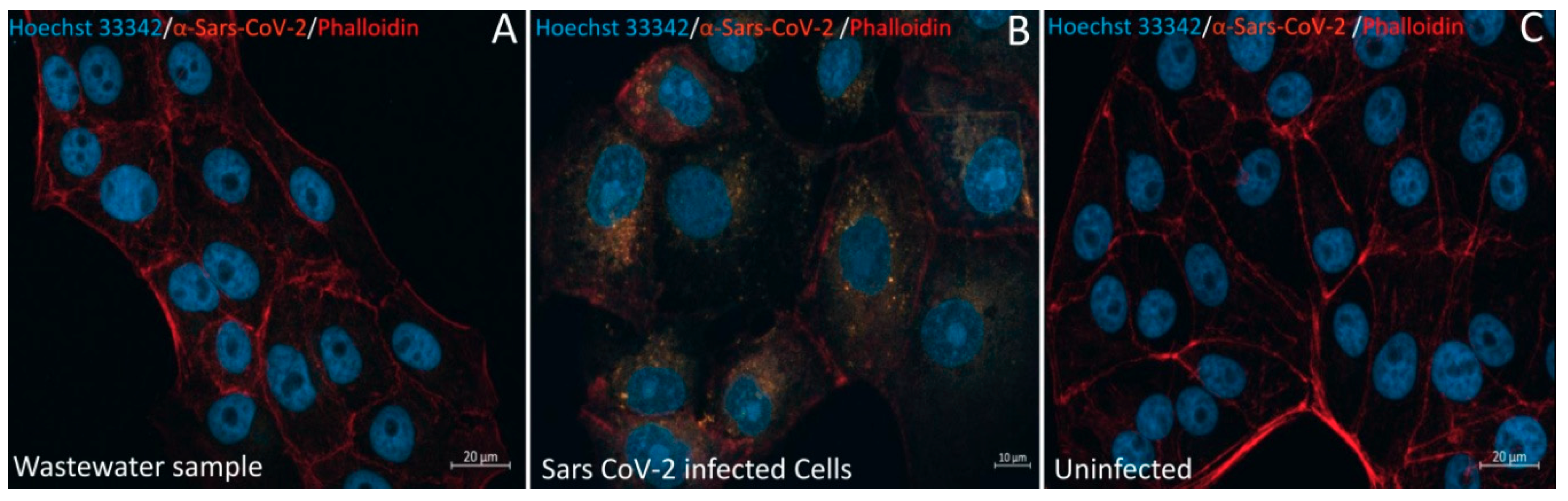 Pathogens | Free Full-Text | Microscopic Observation of SARS-Like 
