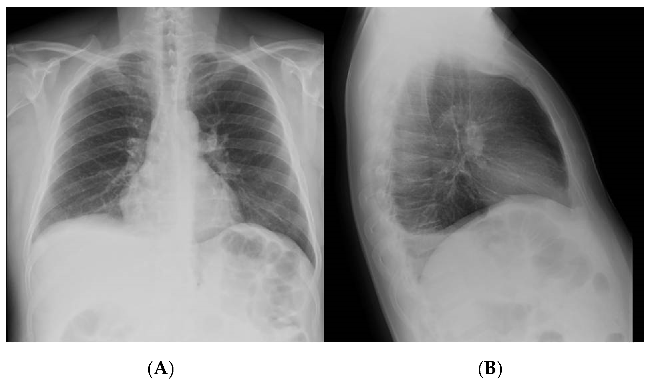 Pathogens 10 00535 g001 Pathogens 10 00535 g001