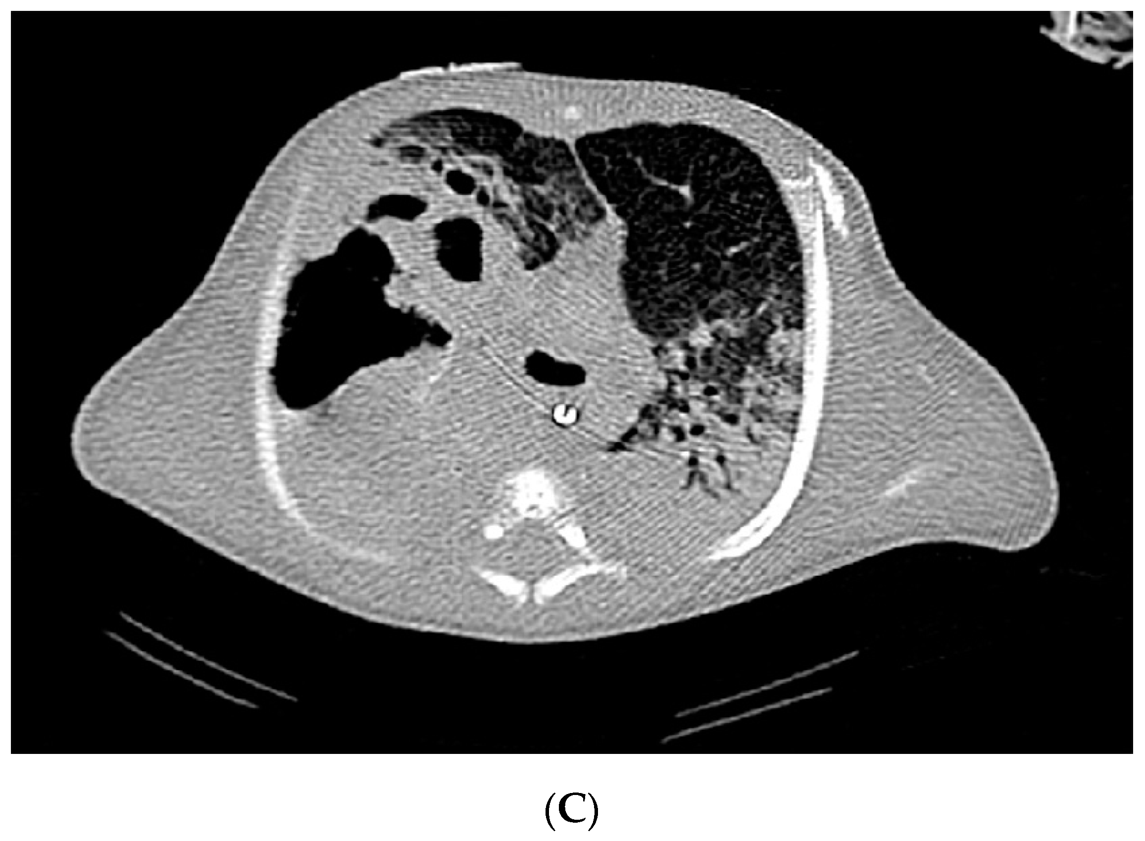 Pathogens 10 01031 g001b Pathogens 10 01031 g001b