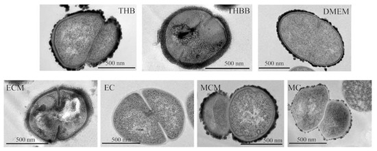 streptococcus pneumoniae electron micrograph