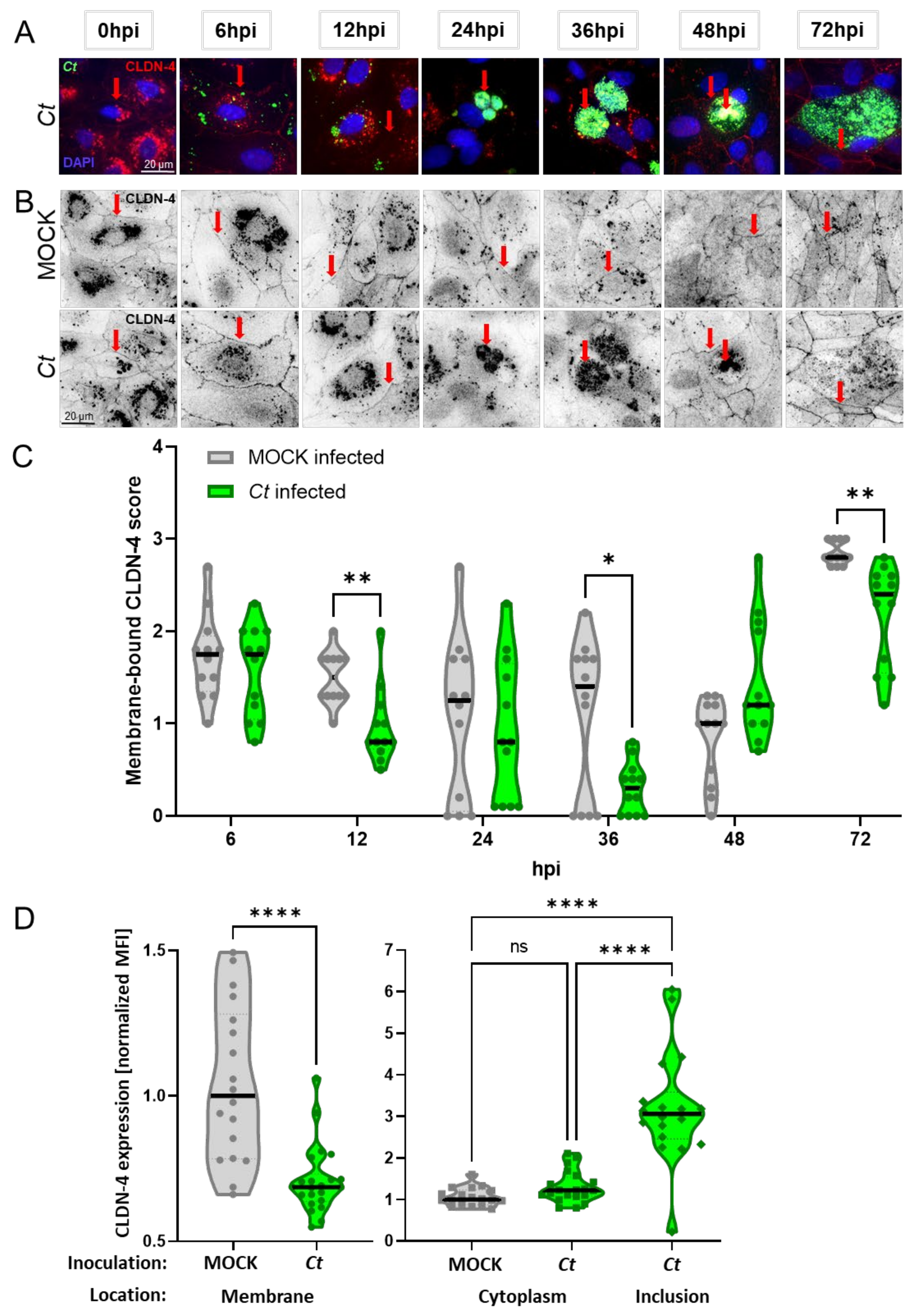 Increased cell membrane permeability of HeLa cells after C. trachomatis