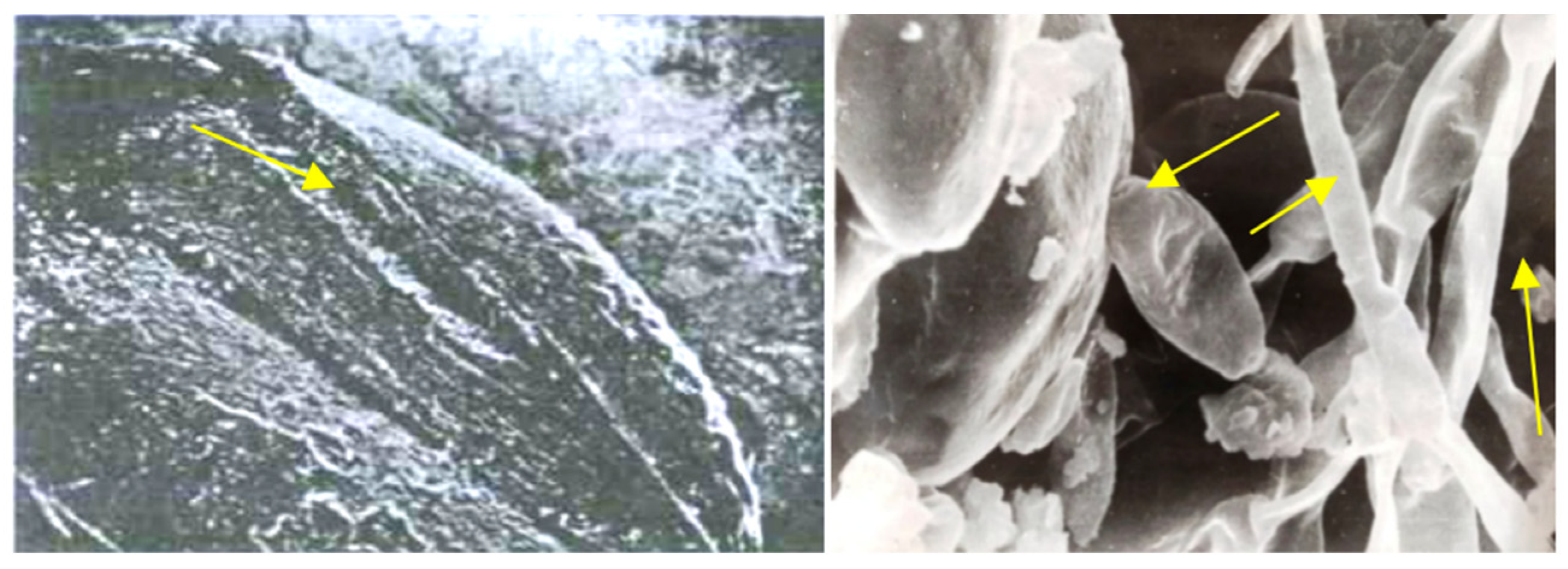 Pathogens 11 00376 g007
