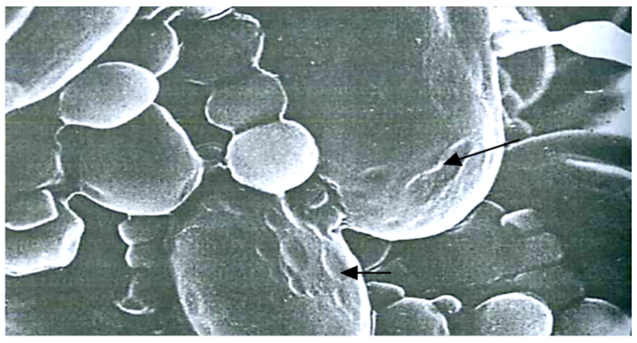 Pathogens 11 00376 g009