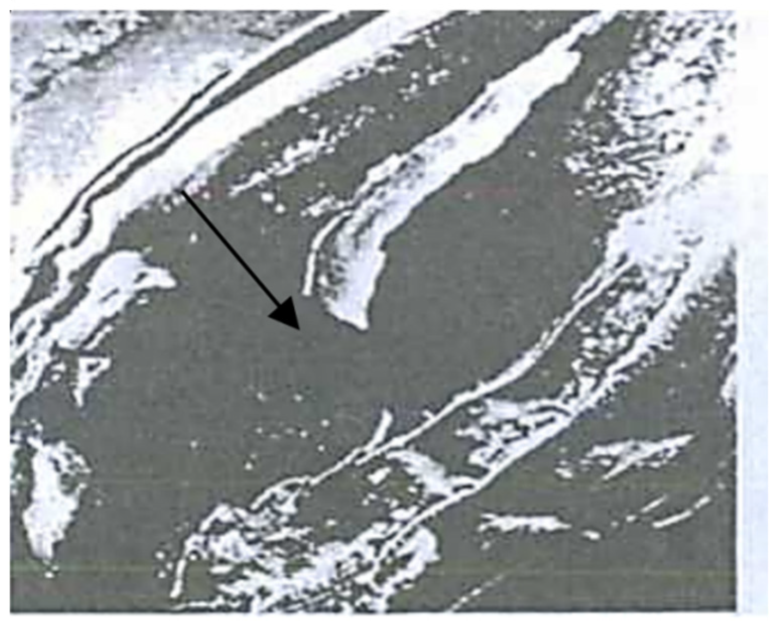 Pathogens 11 00376 g011
