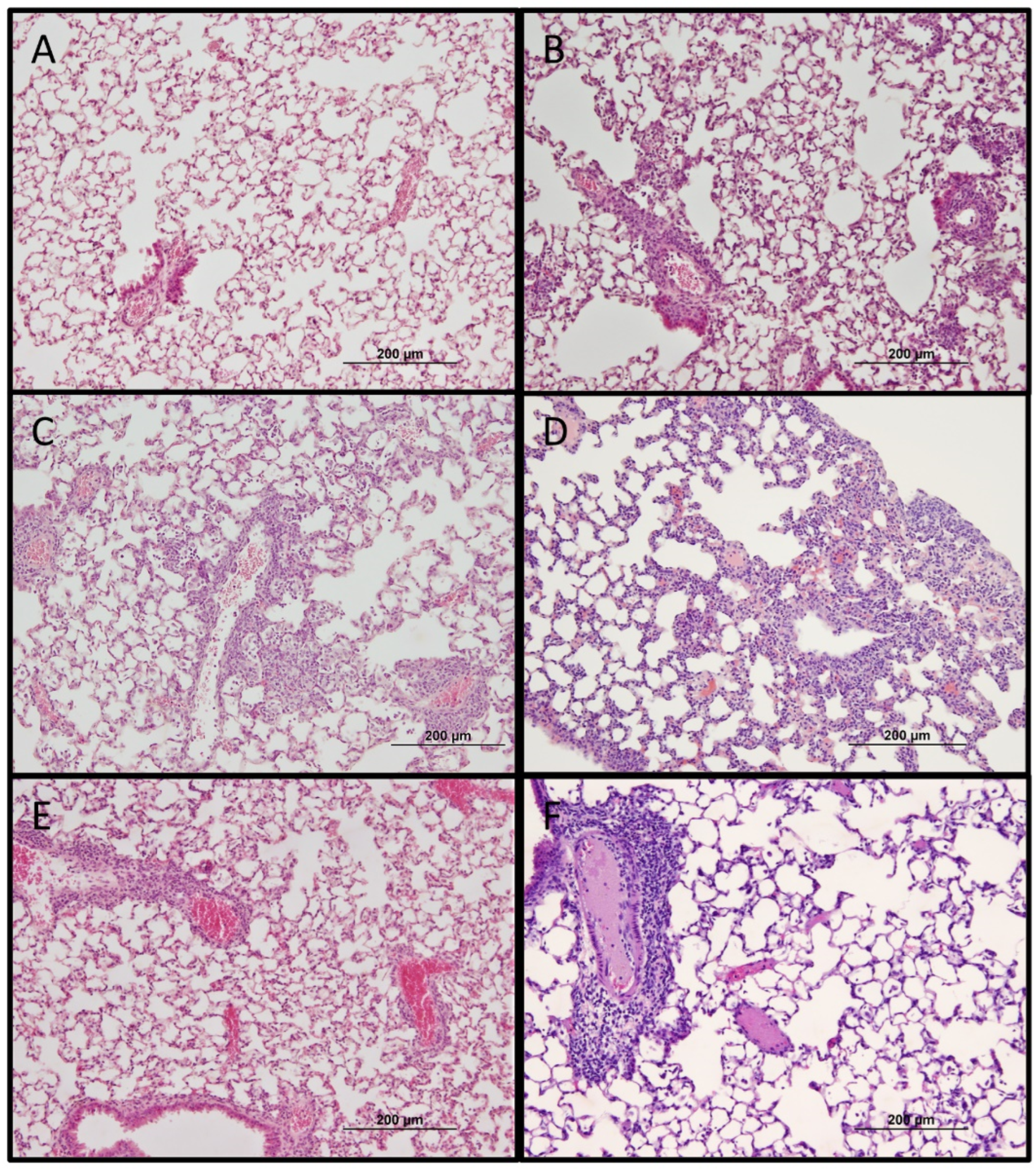 Pathogens 11 00512 g006