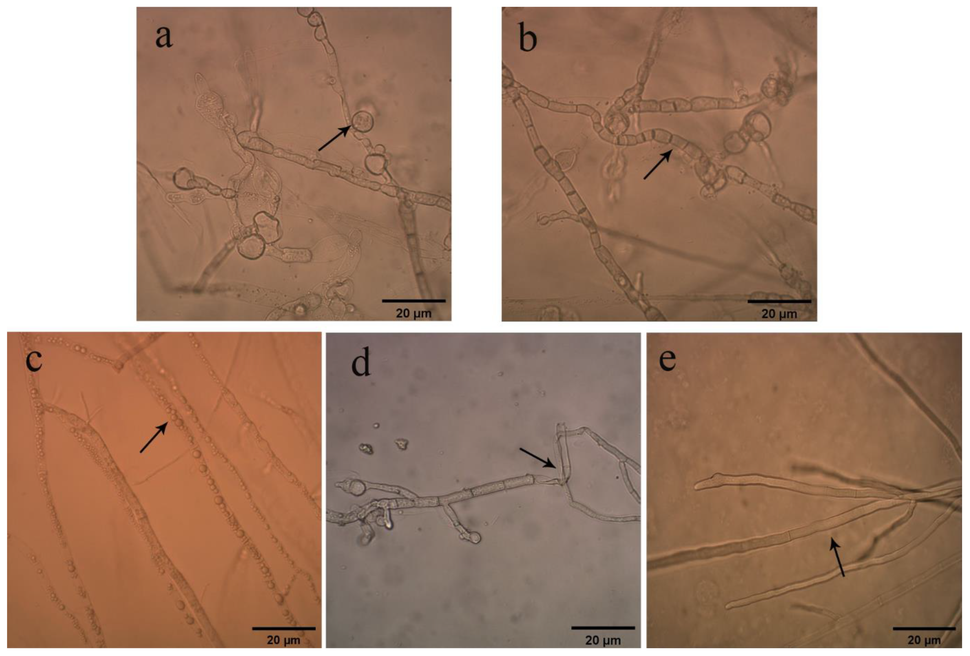 Pathogens 11 00595 g001