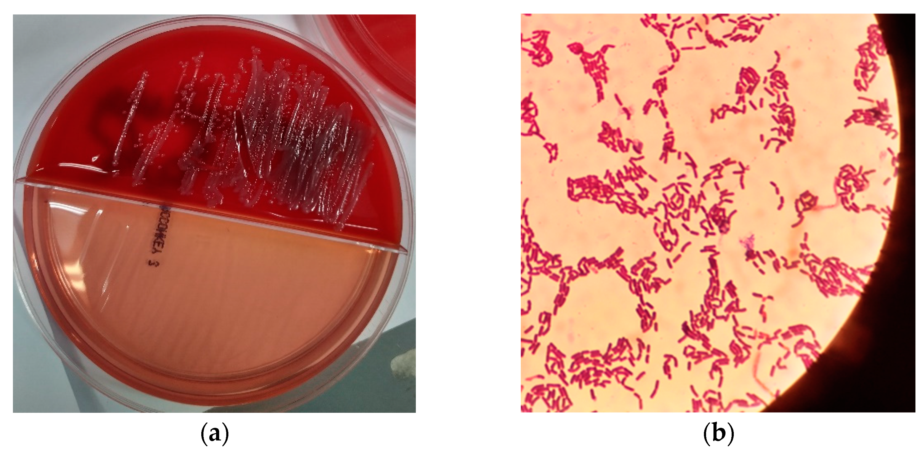 bacillus subtilis blood agar