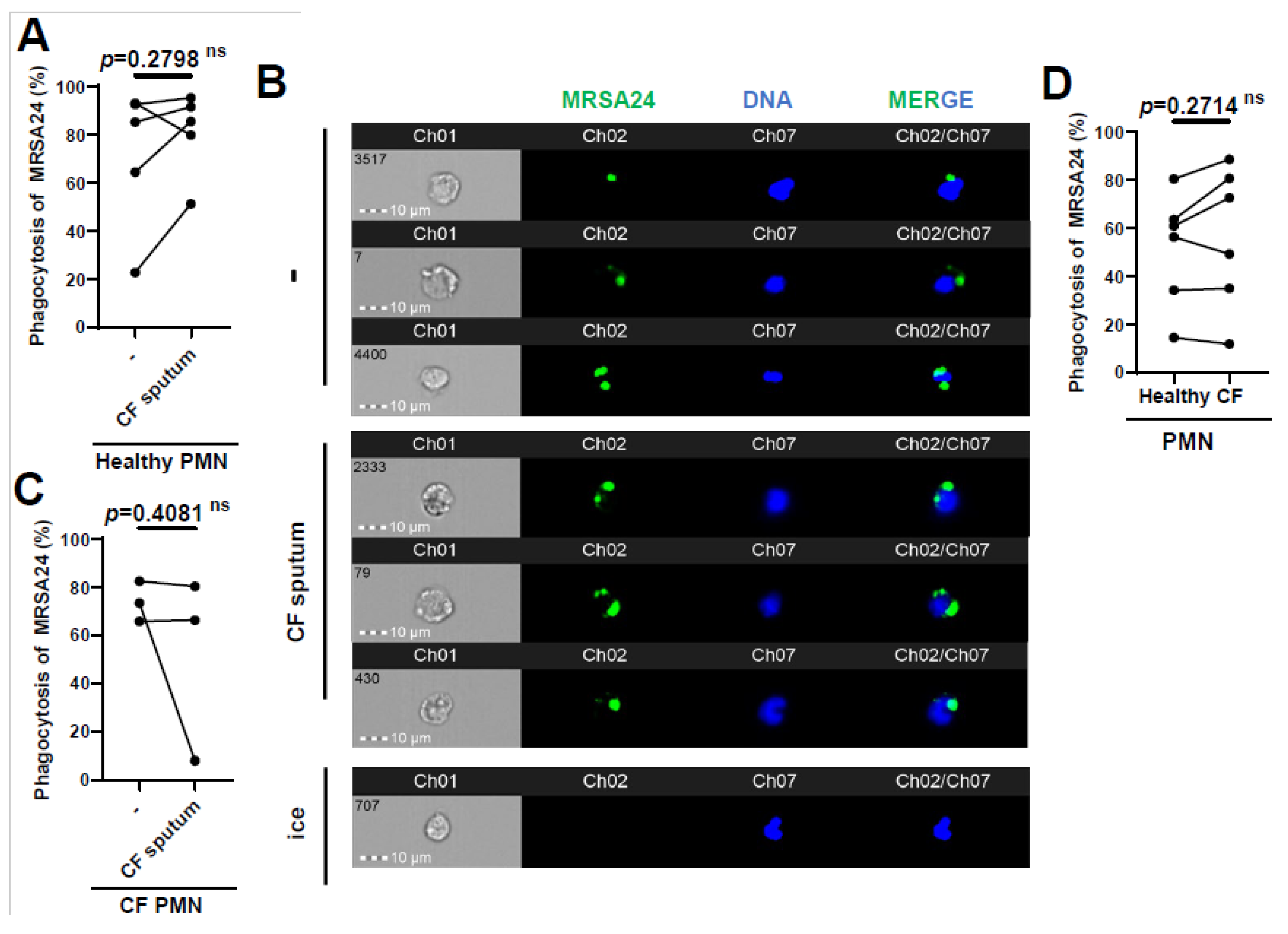 Staphylococcus aureus and Neutrophil Extracellular Traps: The Master  Manipulator Meets Its Match in Immunothrombosis