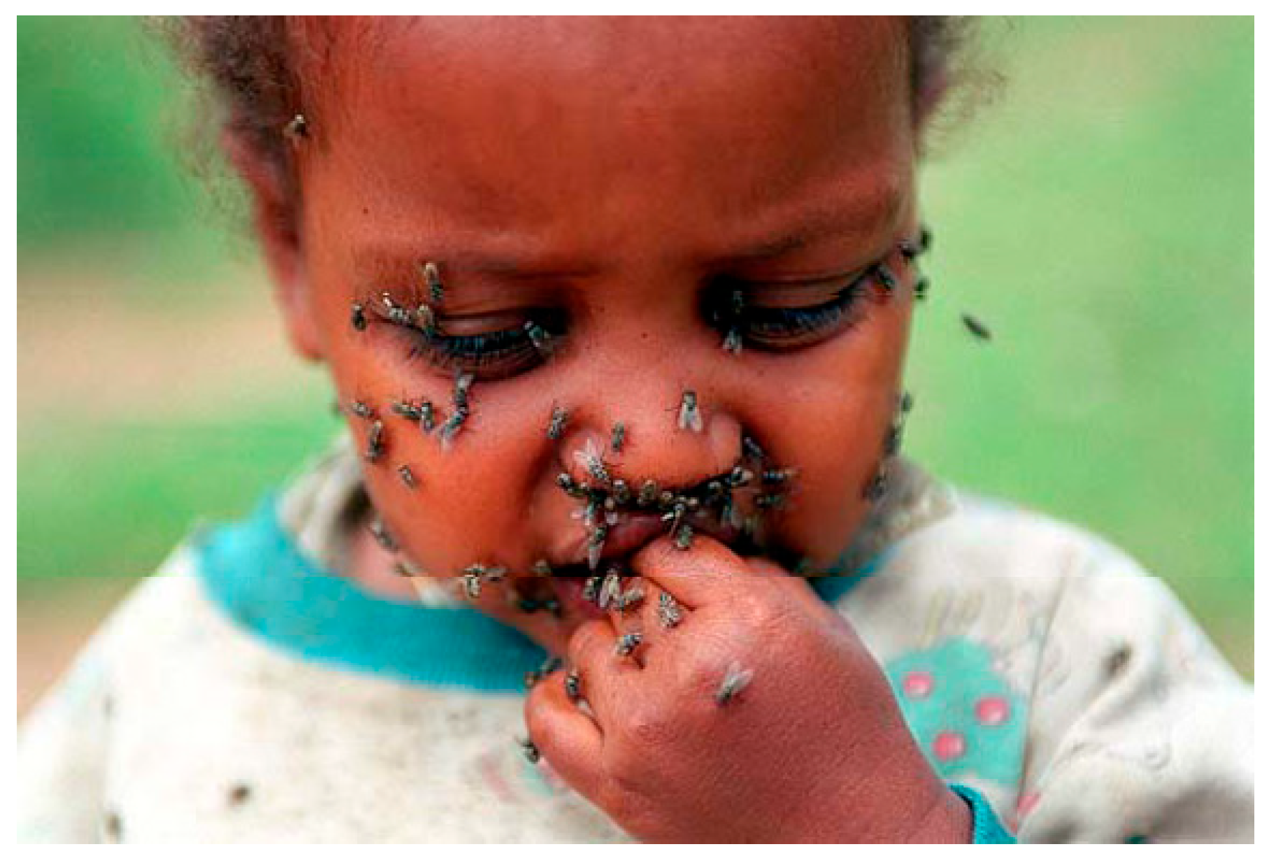 Community Eye Health Journal » Trachoma and fly control