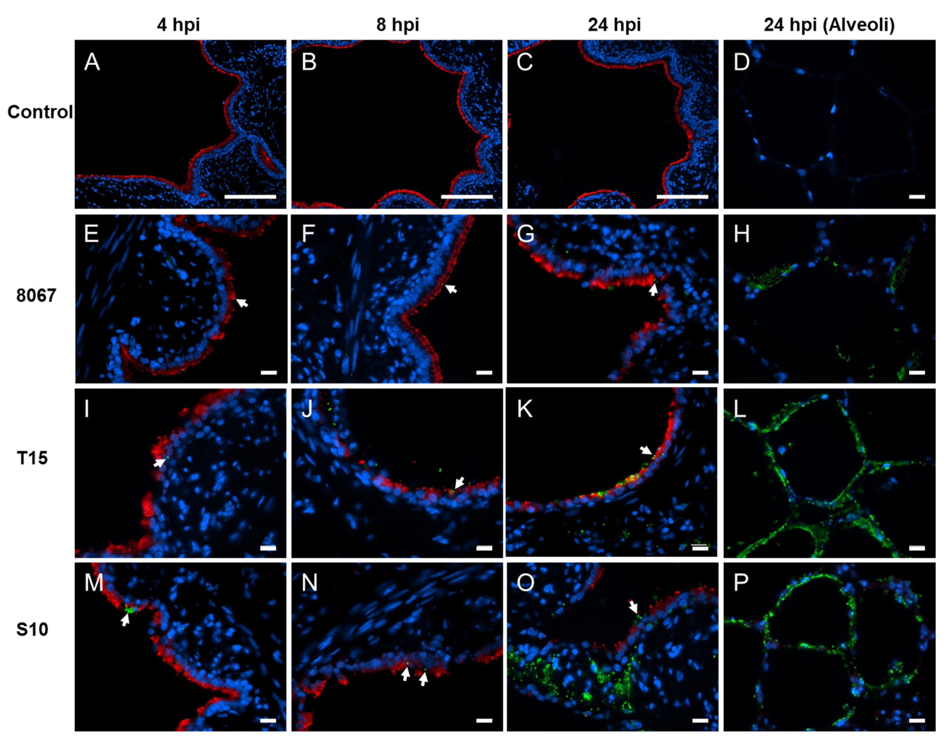 Pathogens | Free Full-Text | Transcriptional Host Responses to