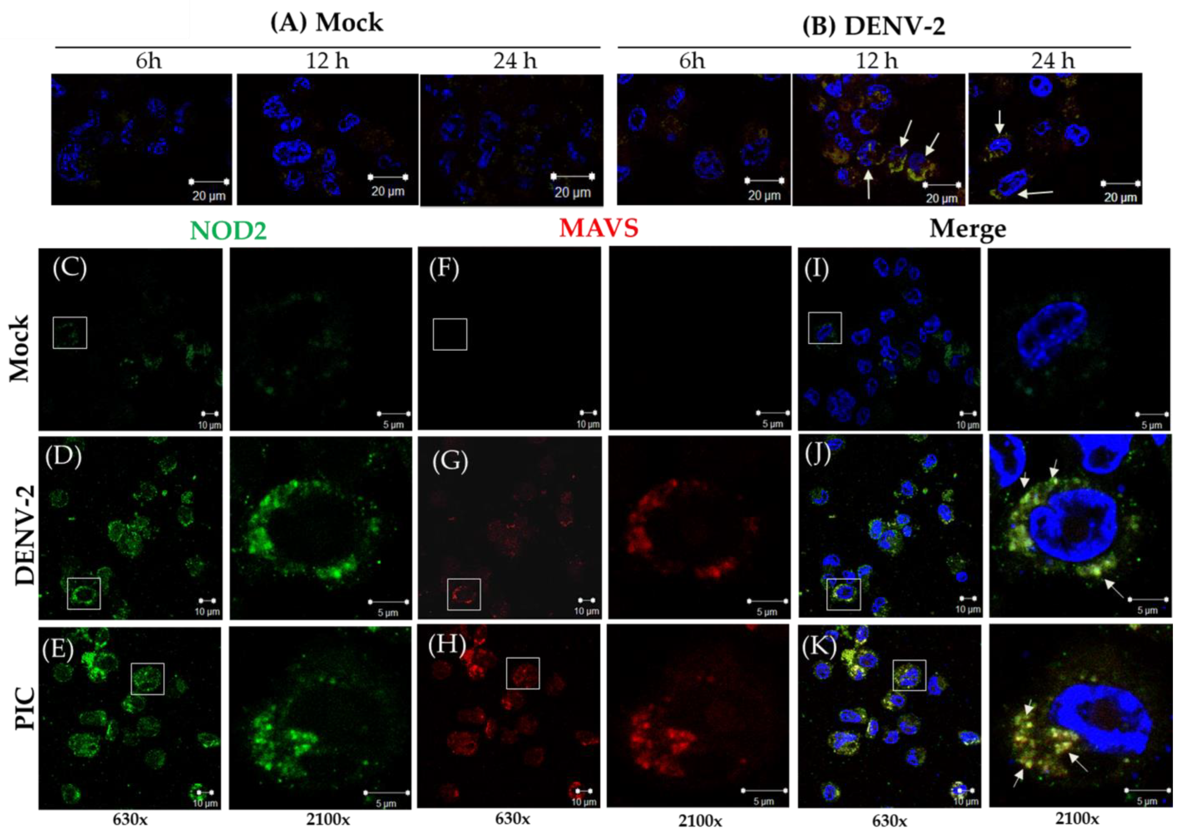Pathogens 13 00306 g002