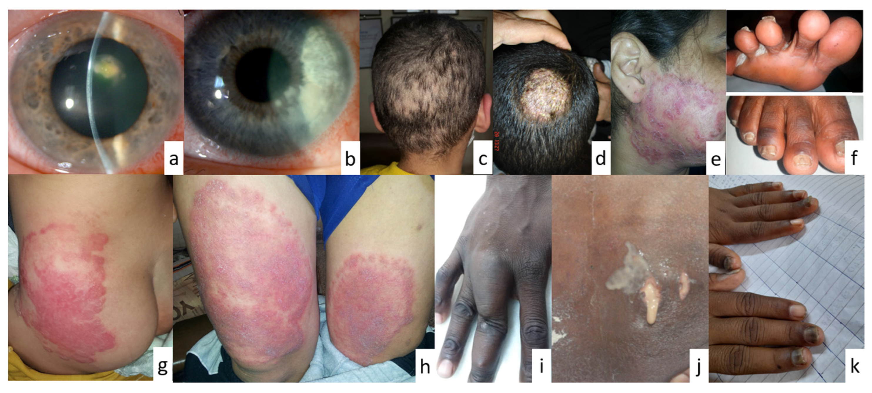 Pathogens 13 00426 g004 Pathogens 13 00426 g004