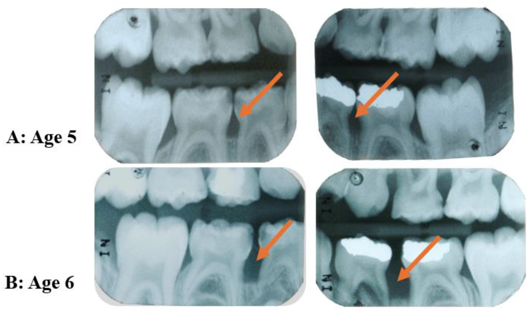 Pathogens 13 00580 g006