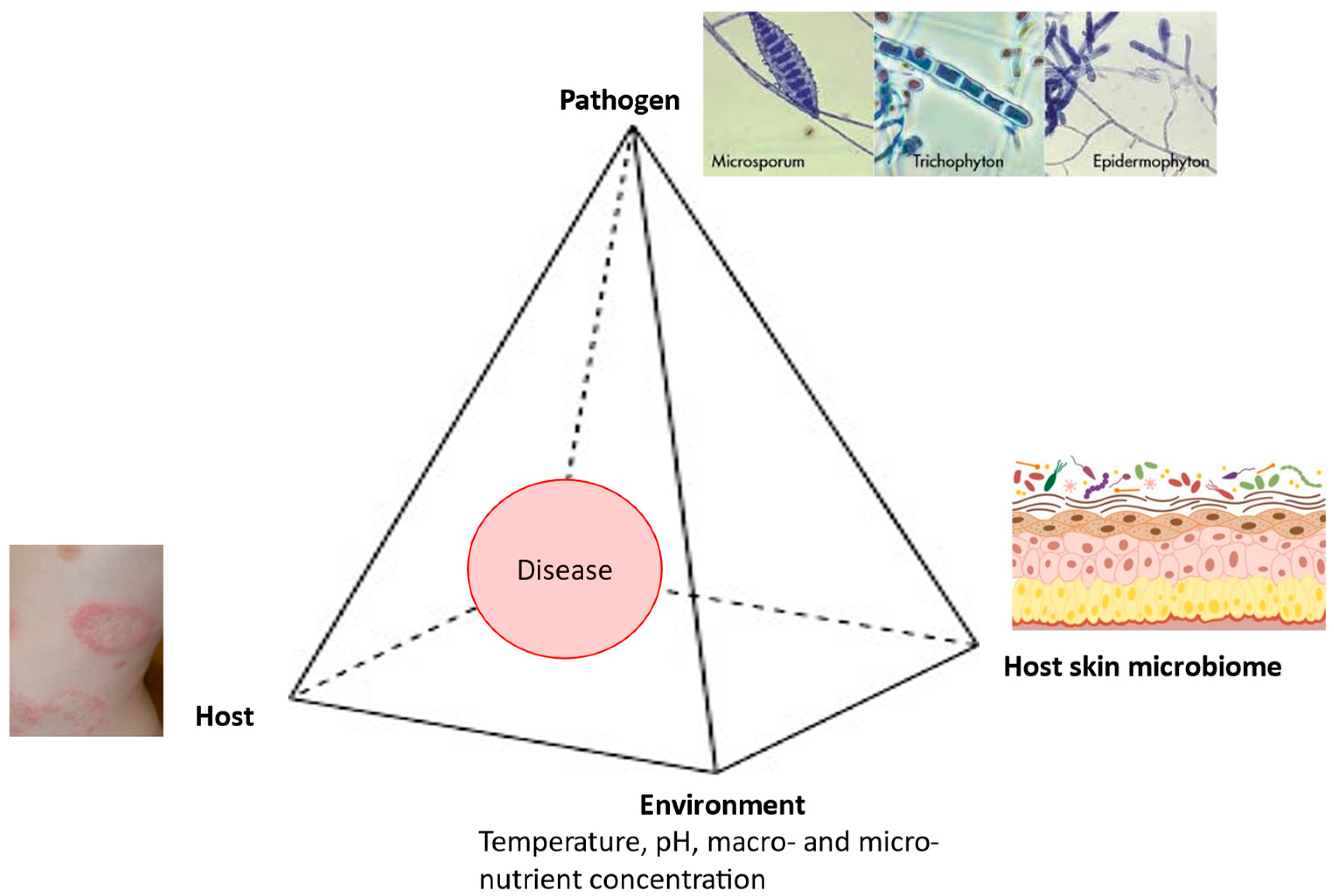 Host-Pathogen Interaction and Resistance Mechanisms in Dermatophytes