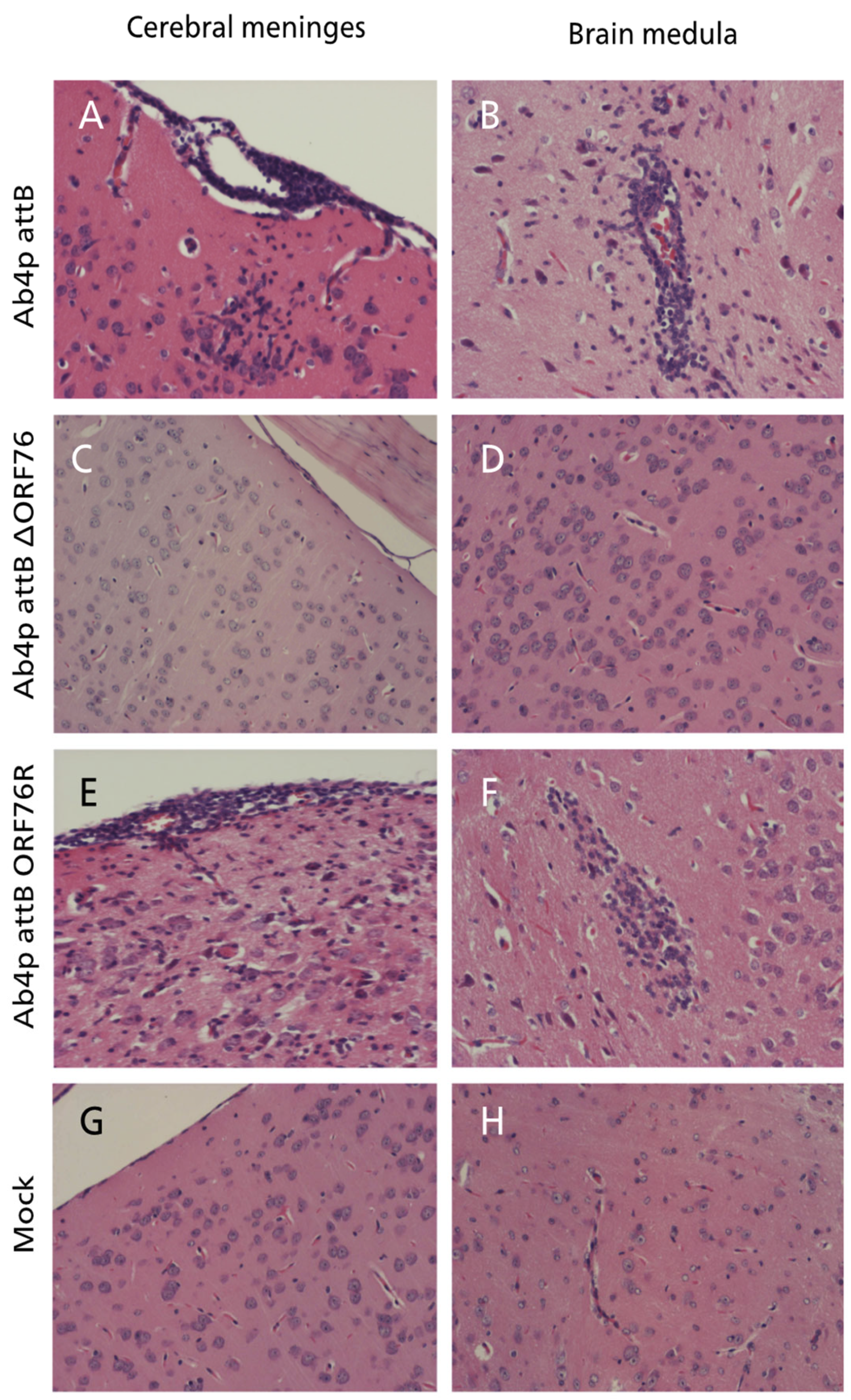 Pathogens 13 00865 g008 Pathogens 13 00865 g008
