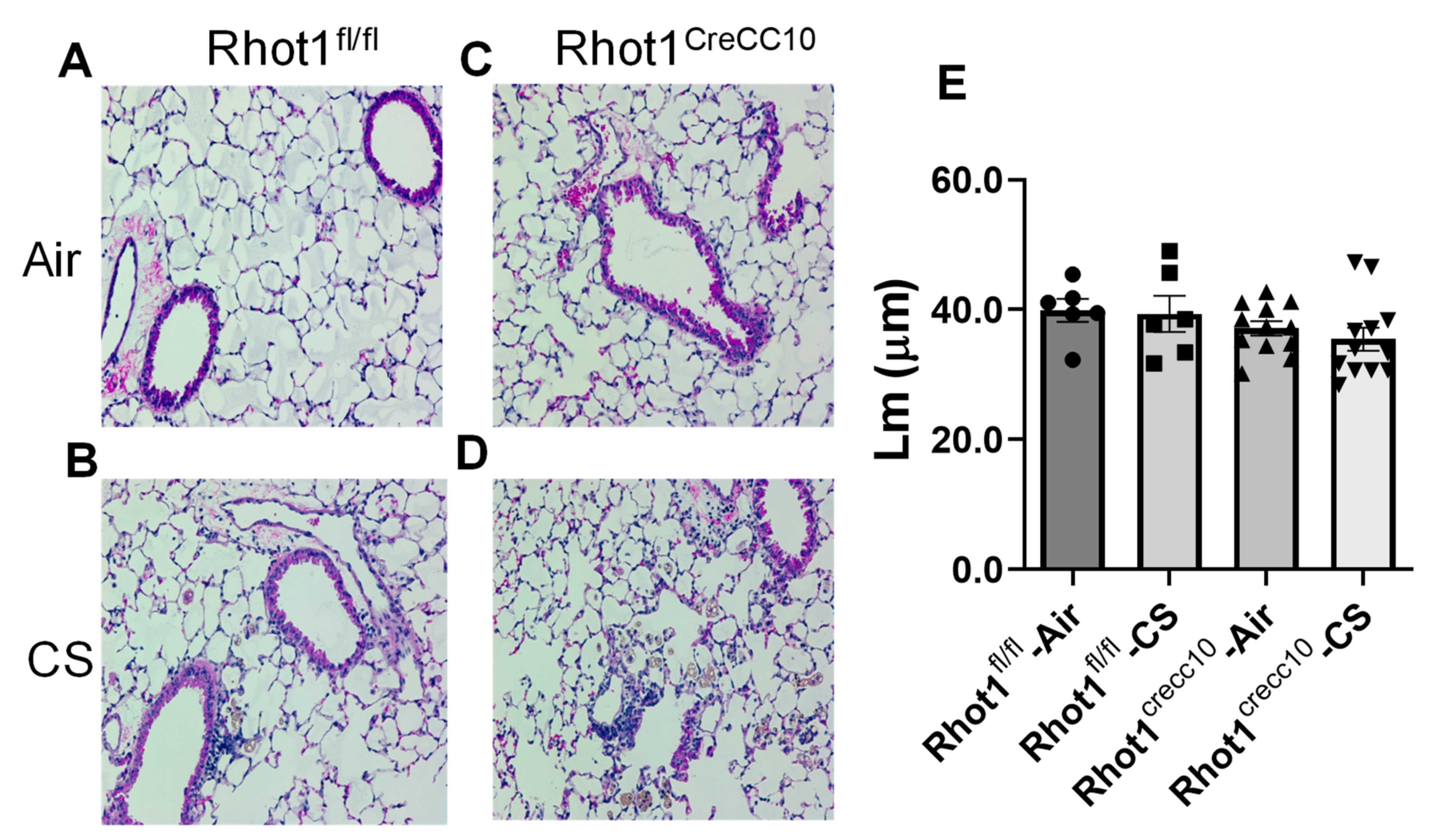 Pathophysiology 28 00033 g006
