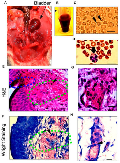 Pathophysiology Free Full Text Sex Differences In Immune Cell Infiltration And Hematuria In 