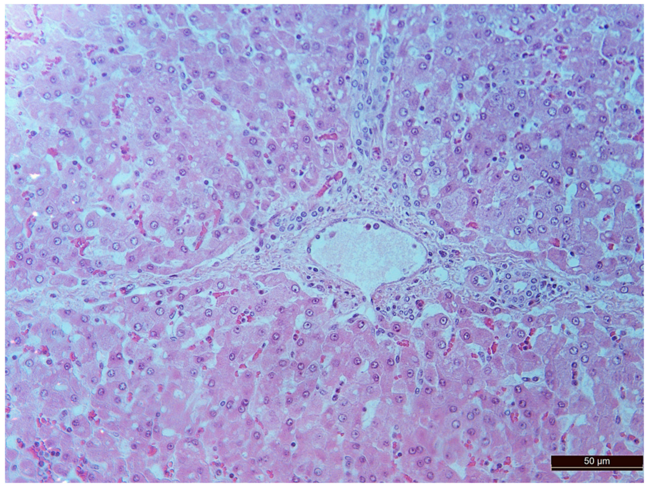 Pathophysiology 30 00037 g006