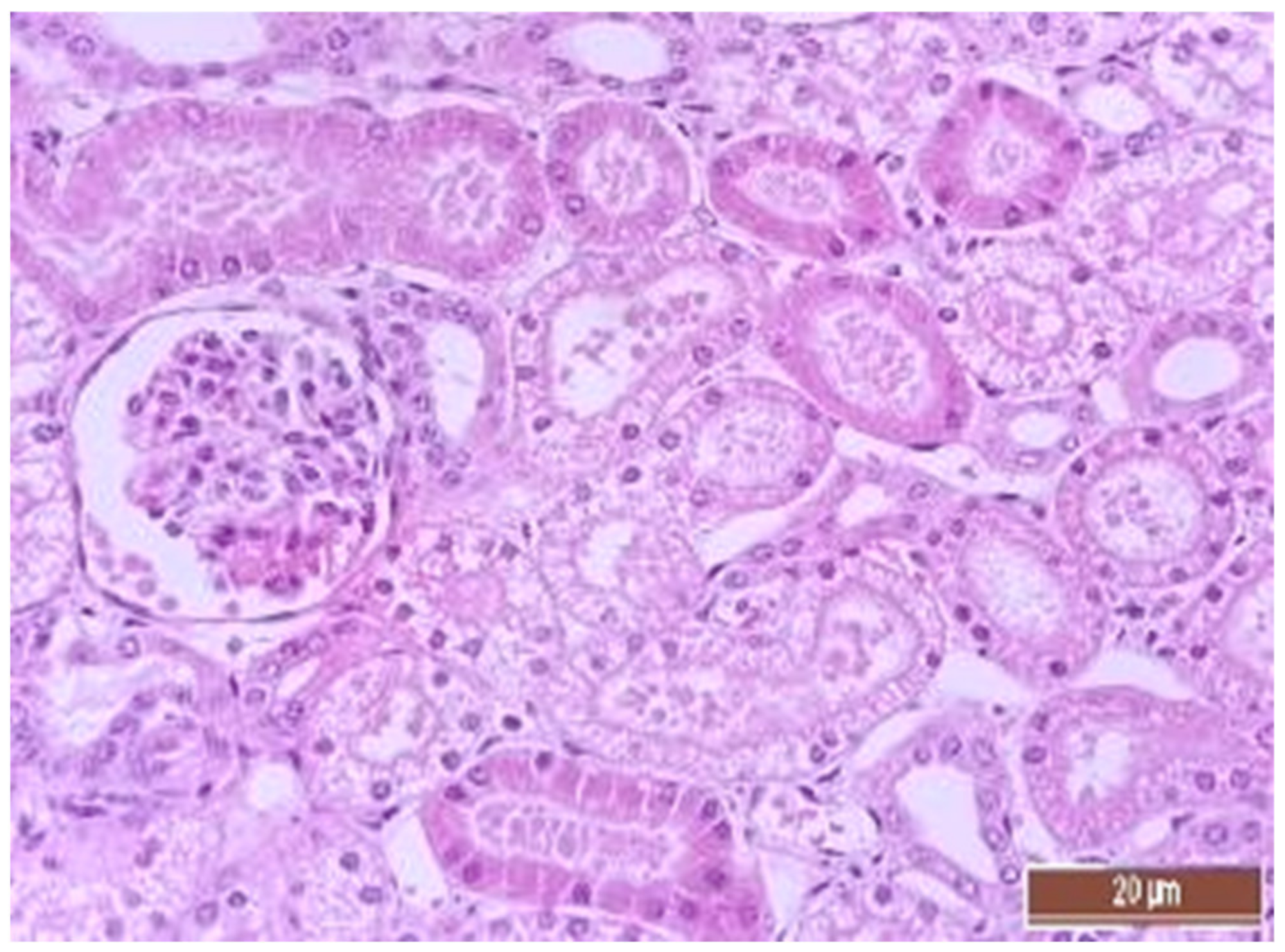 Pathophysiology 30 00037 g011