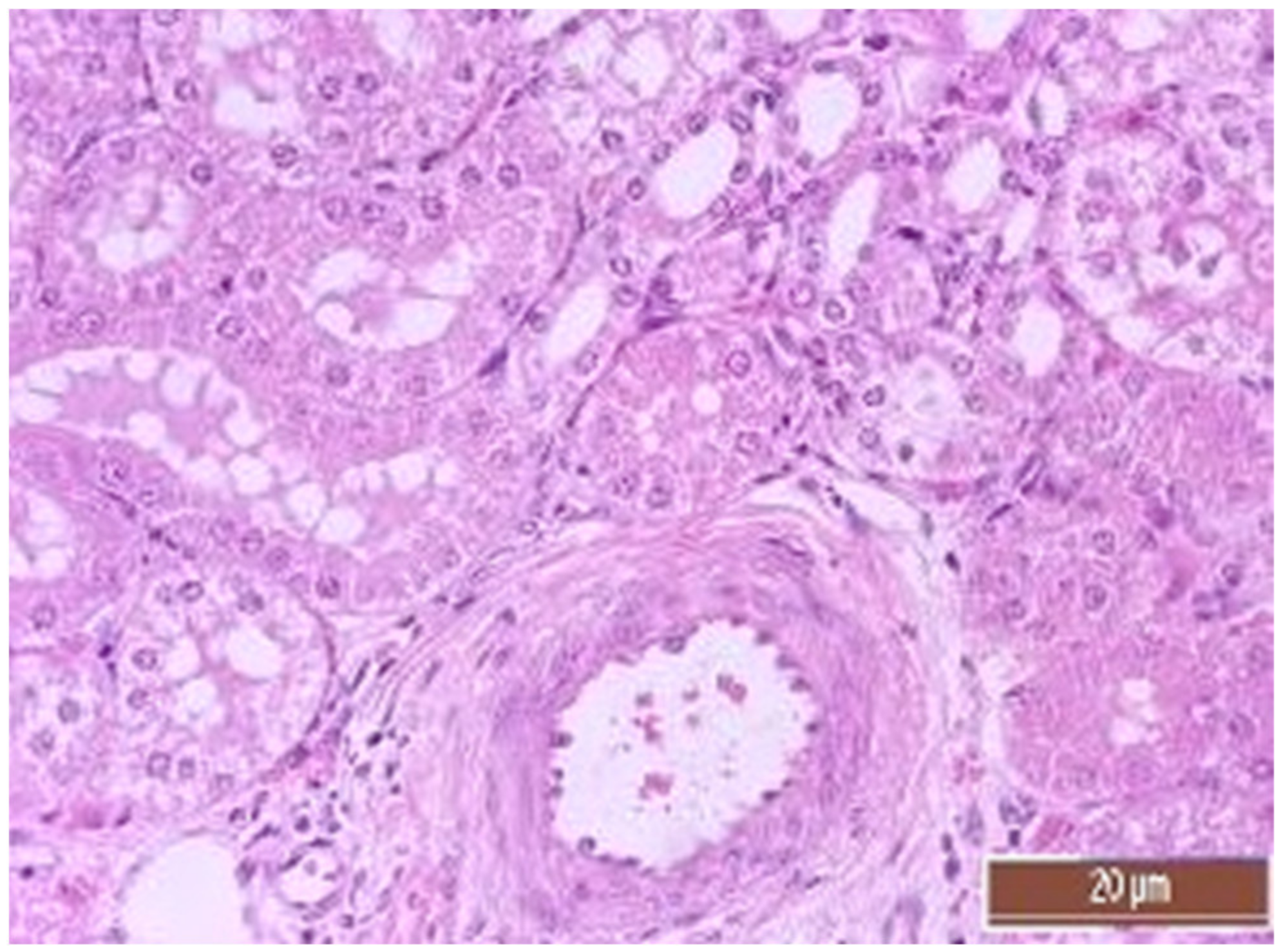 Pathophysiology 30 00037 g013