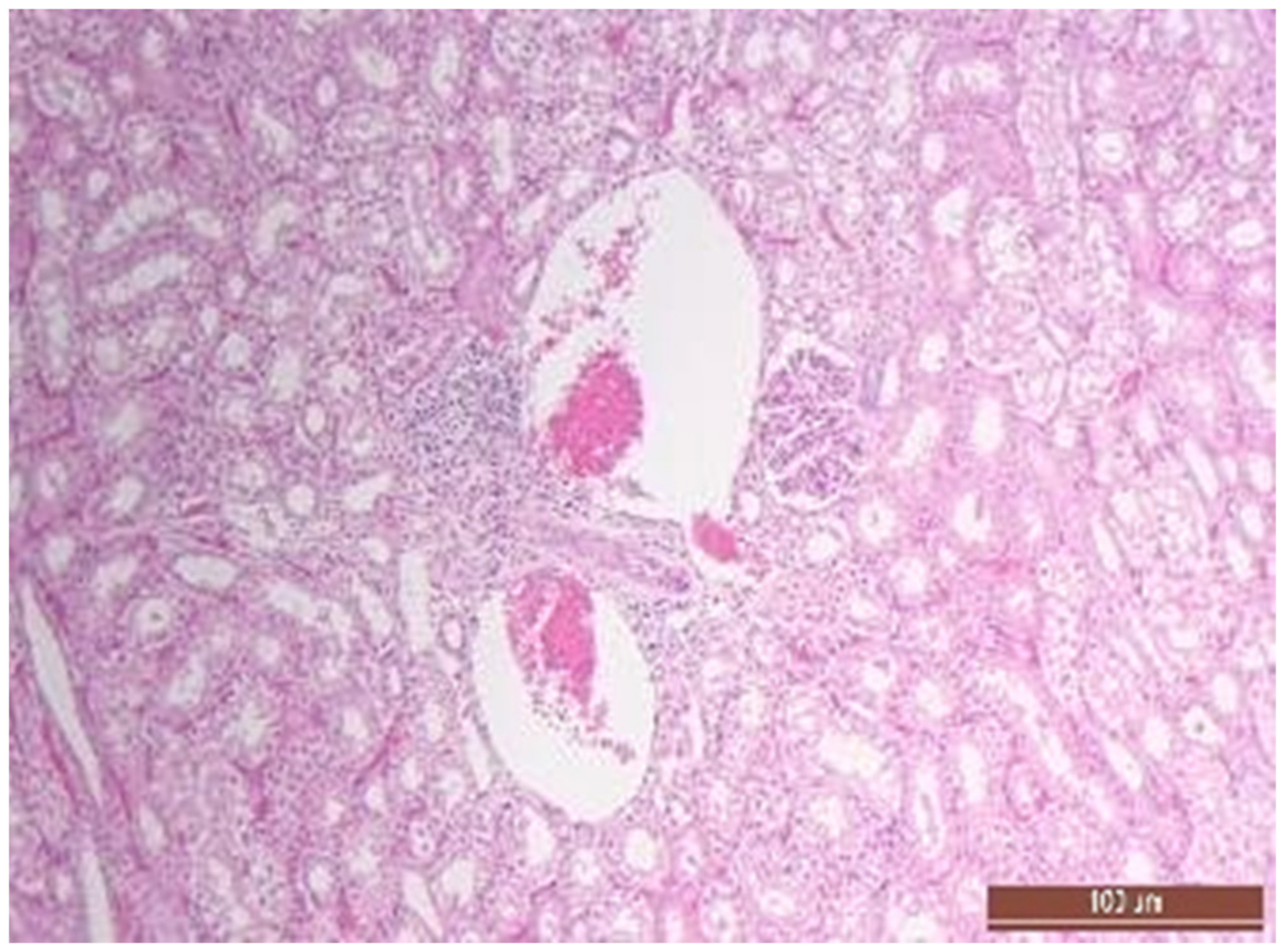 Pathophysiology 30 00037 g014