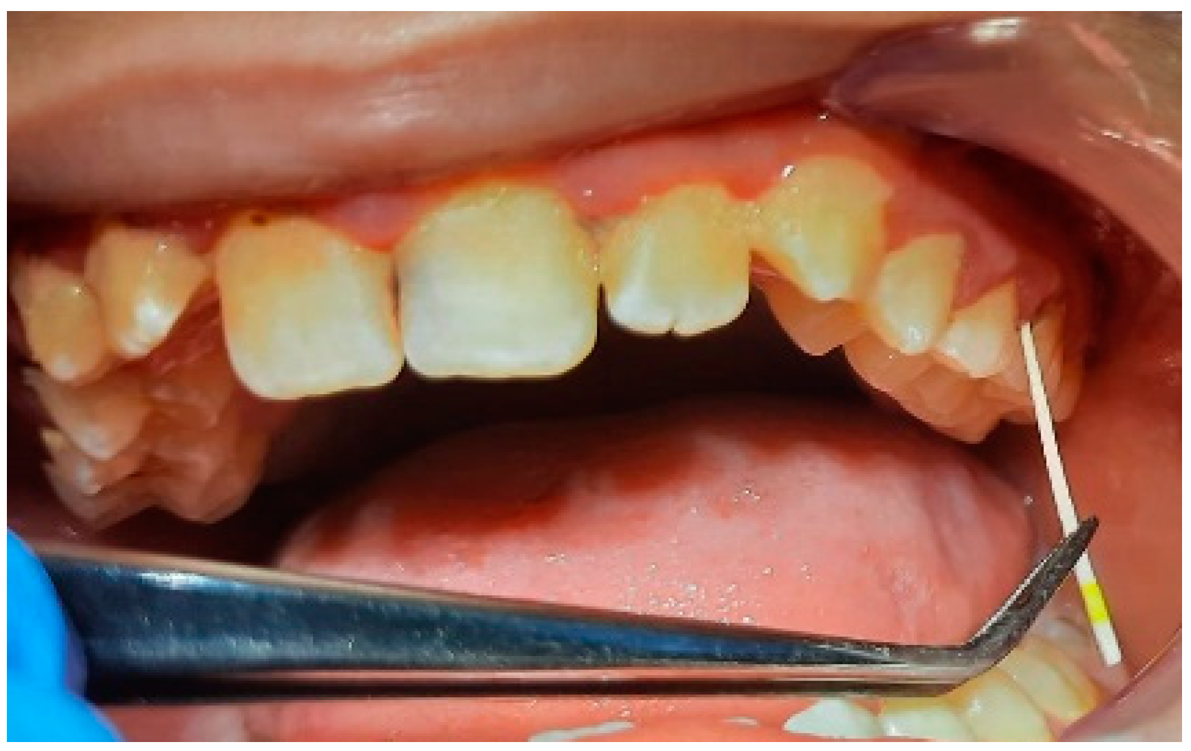 Pediatrrep 16 00041 g007 Pediatrrep 16 00041 g007