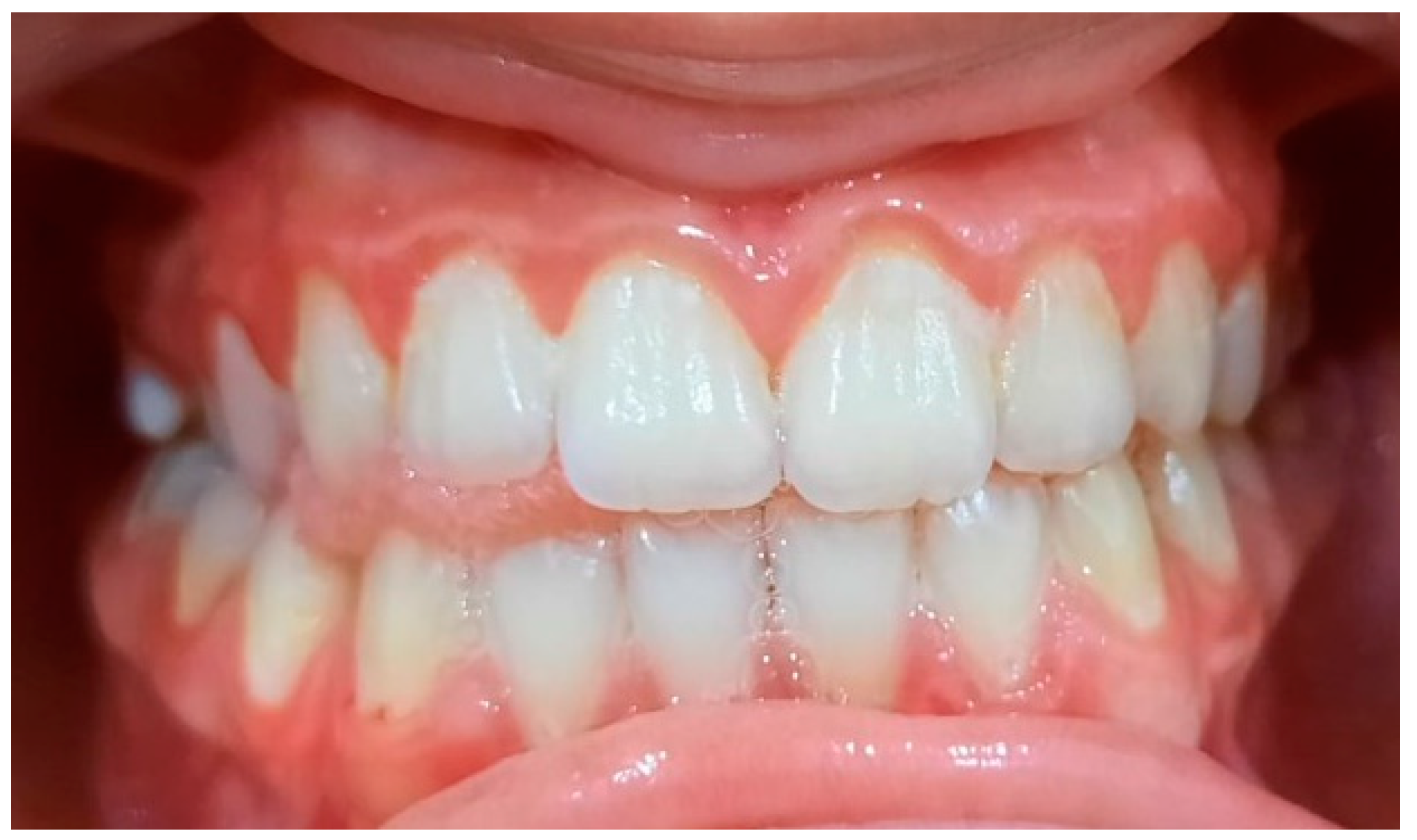 Pediatrrep 16 00041 g010 Pediatrrep 16 00041 g010