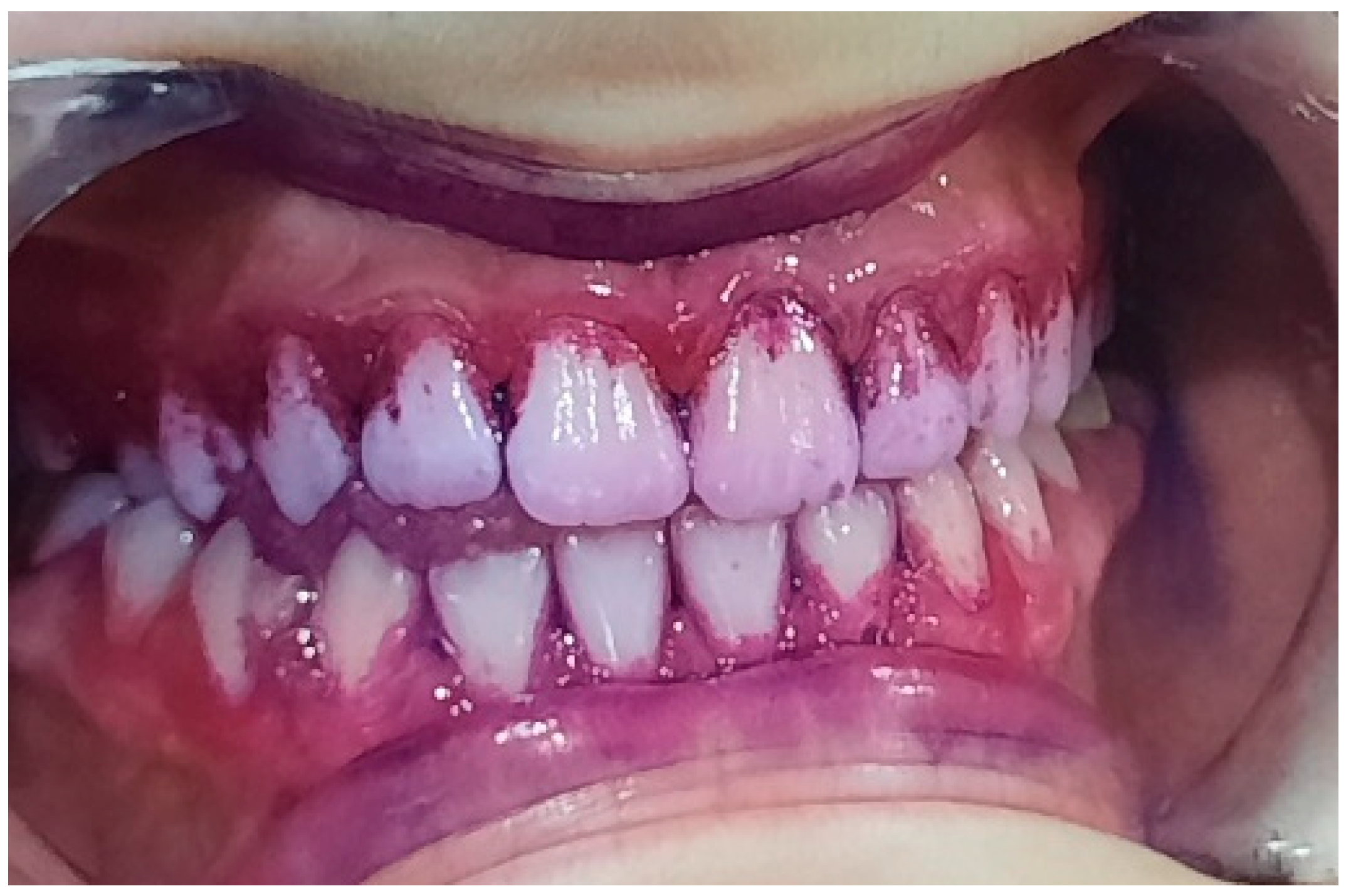 Pediatrrep 16 00041 g011 Pediatrrep 16 00041 g011