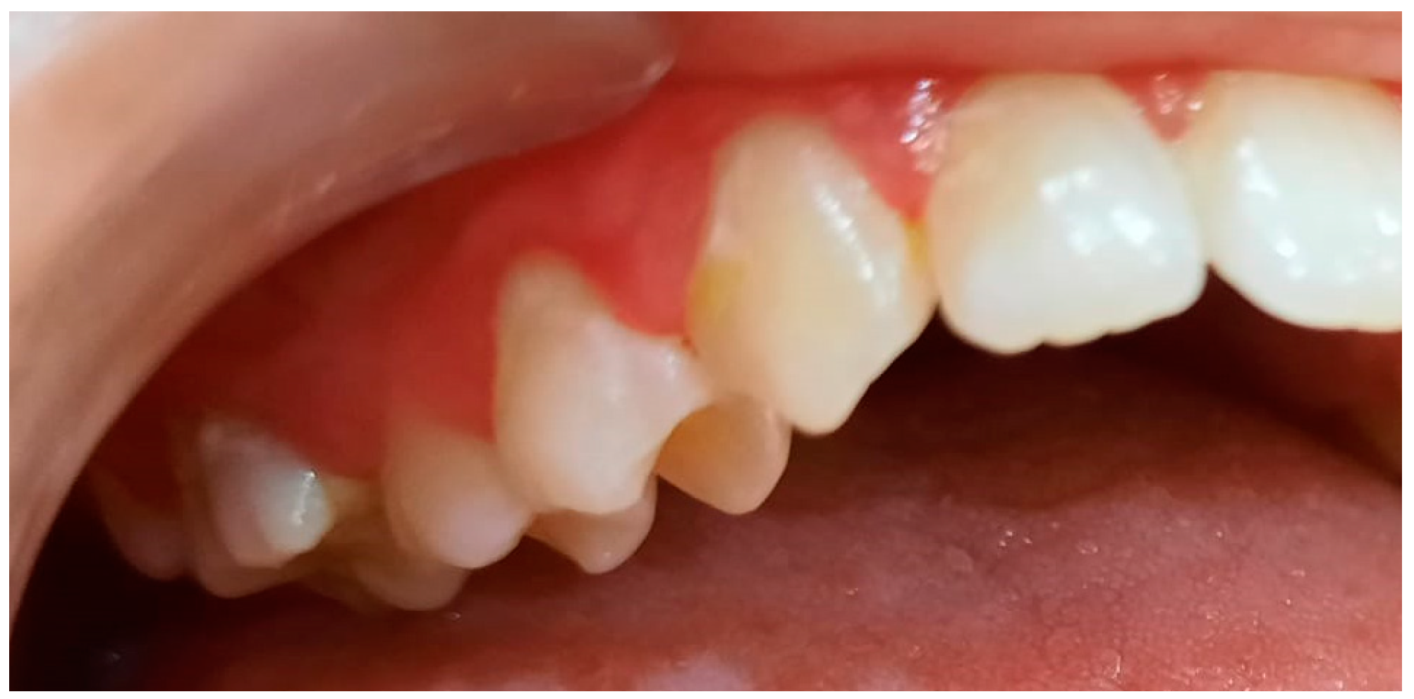 Pediatrrep 16 00041 g013 Pediatrrep 16 00041 g013