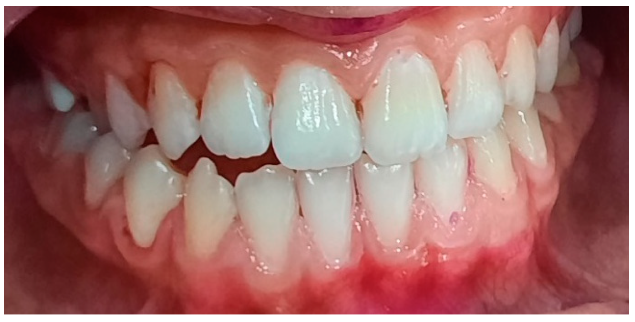 Pediatrrep 16 00041 g014 Pediatrrep 16 00041 g014