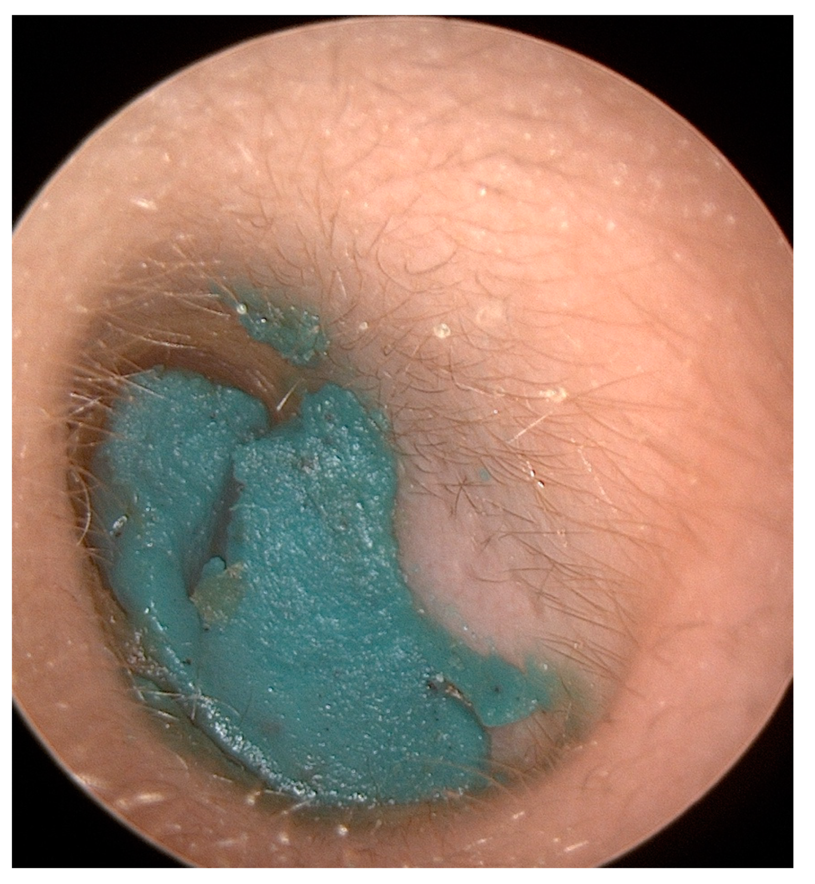 Pediatrrep 16 00042 g001 Pediatrrep 16 00042 g001